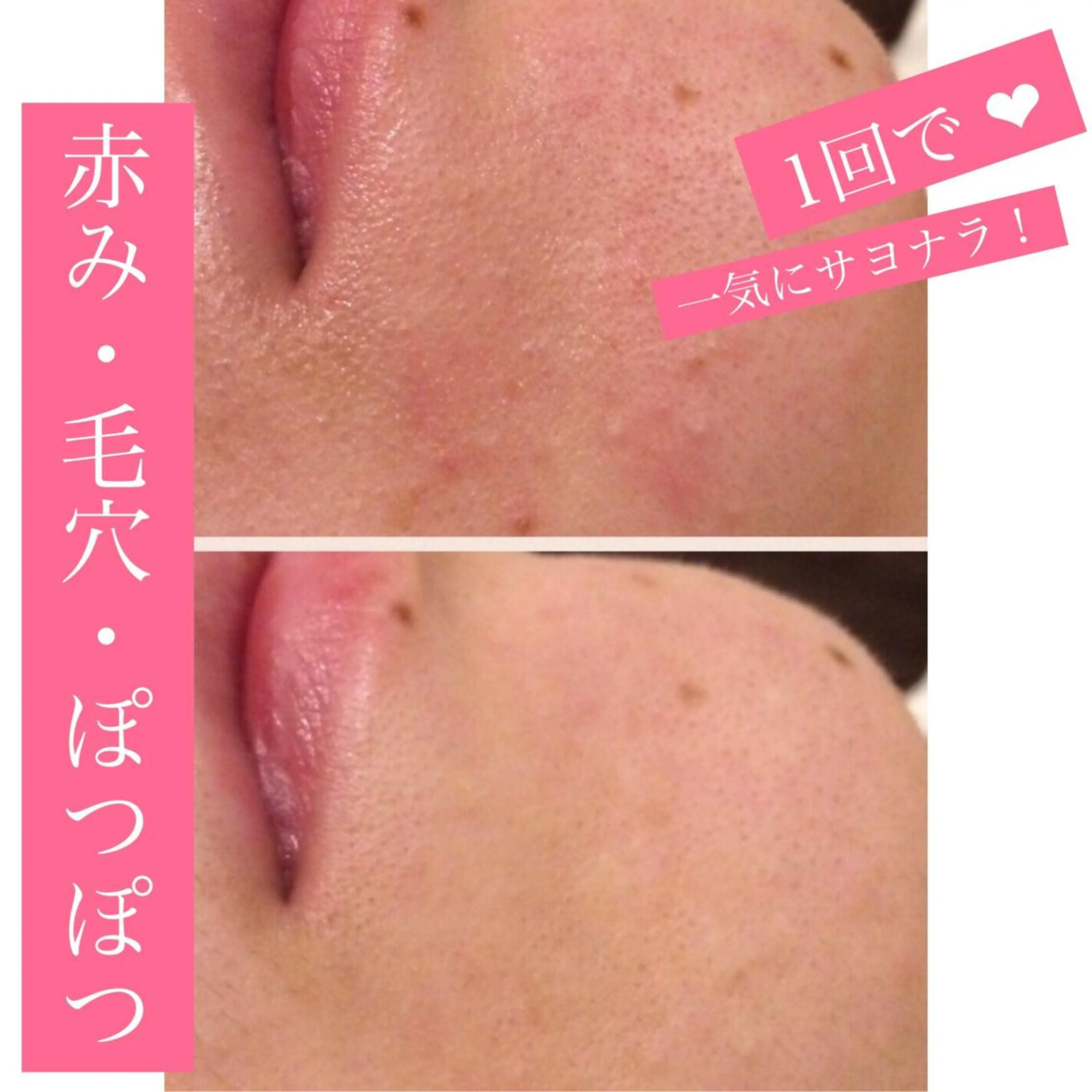 セミロング カラー パーマ ヘアアレンジ メンズ キッズ ネイル マツエク・マツパ 金の糸脱毛 産毛ケア専門のエステ・リラクイメージ