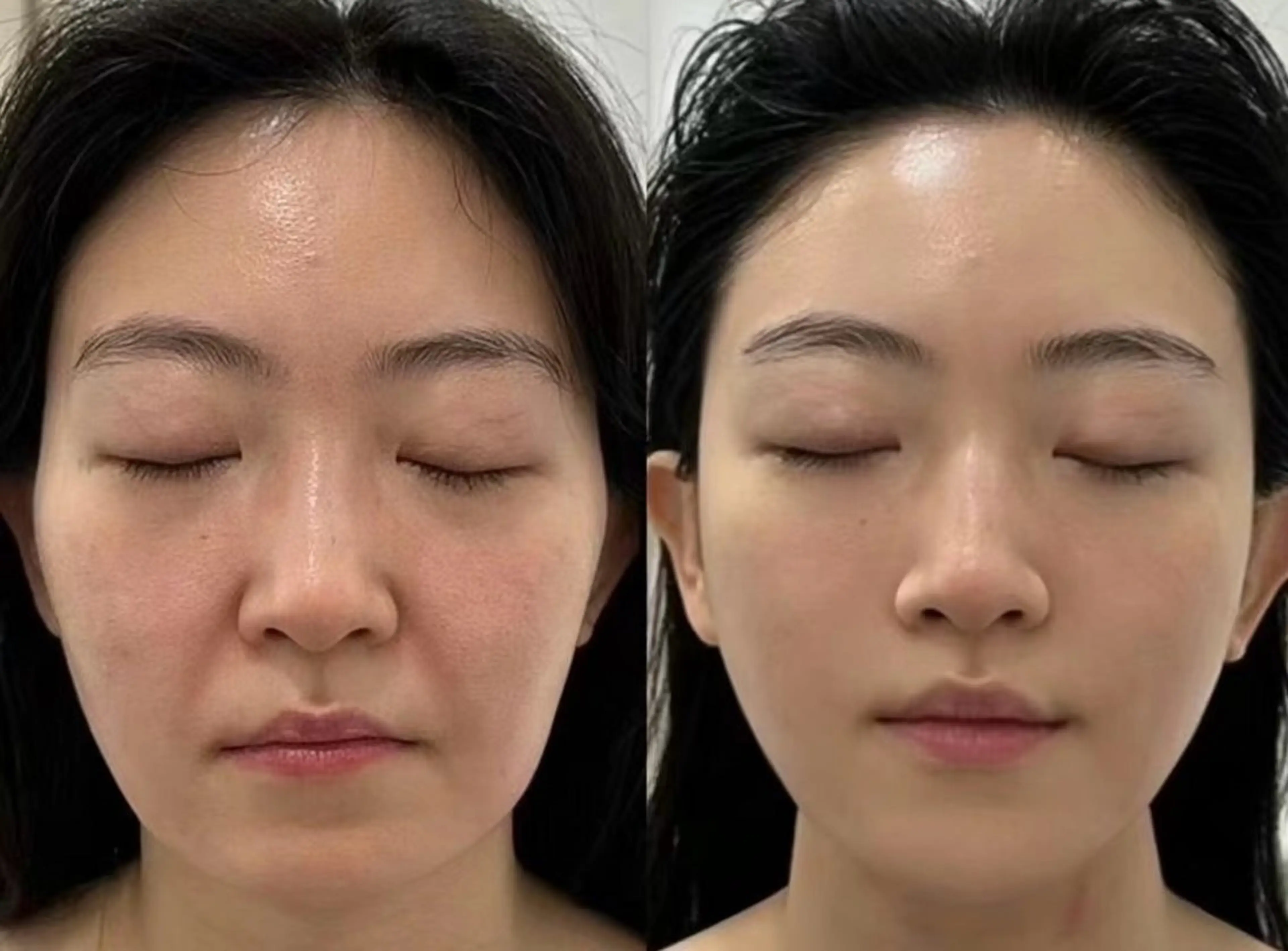 ネイル エステ aliaハイフ&水光ジェットサロン所属・aliaハーブ水光店 エステティシャン募集のエステ・リラクイメージ