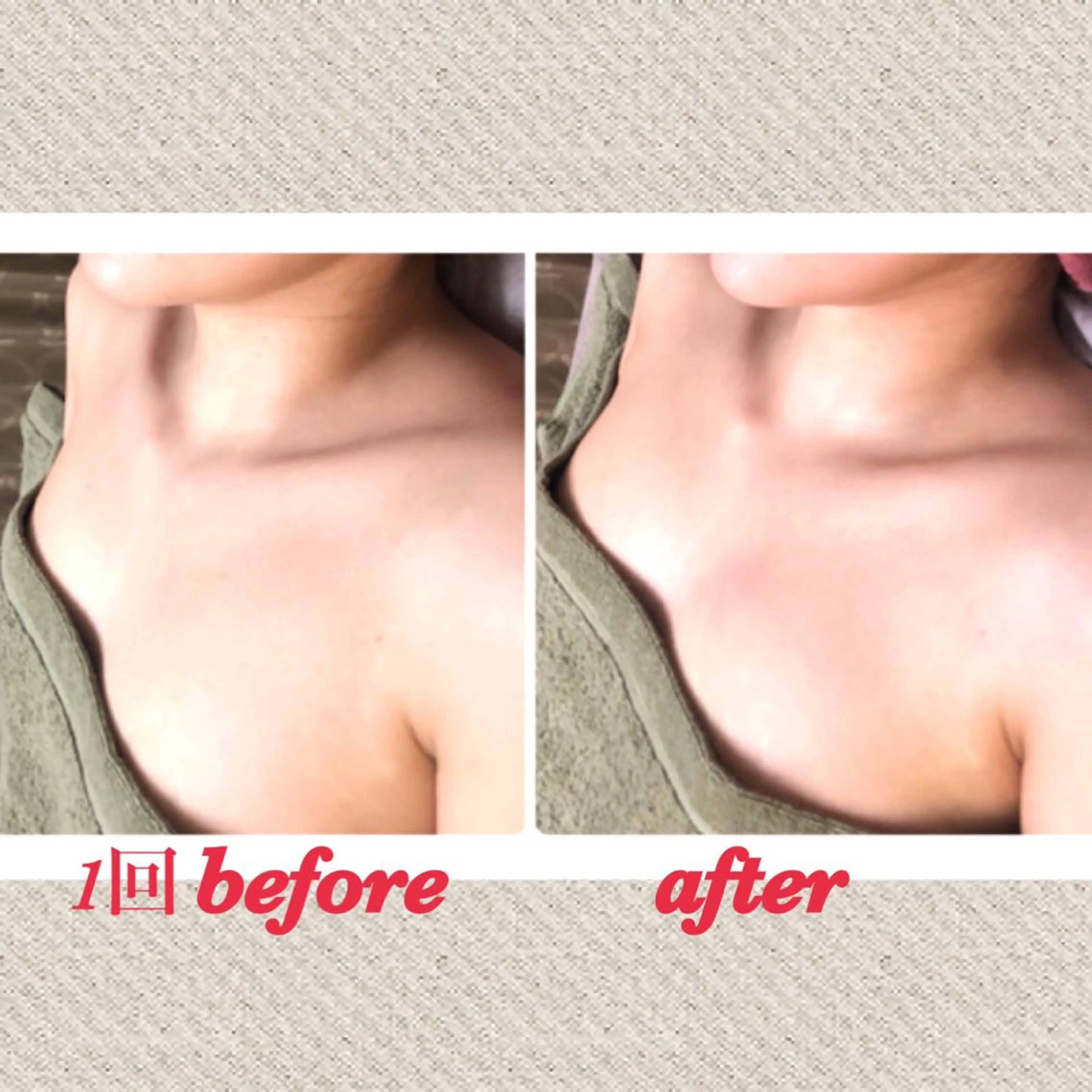 エステ リラク 美ola ビオラのエステ・リラクイメージ