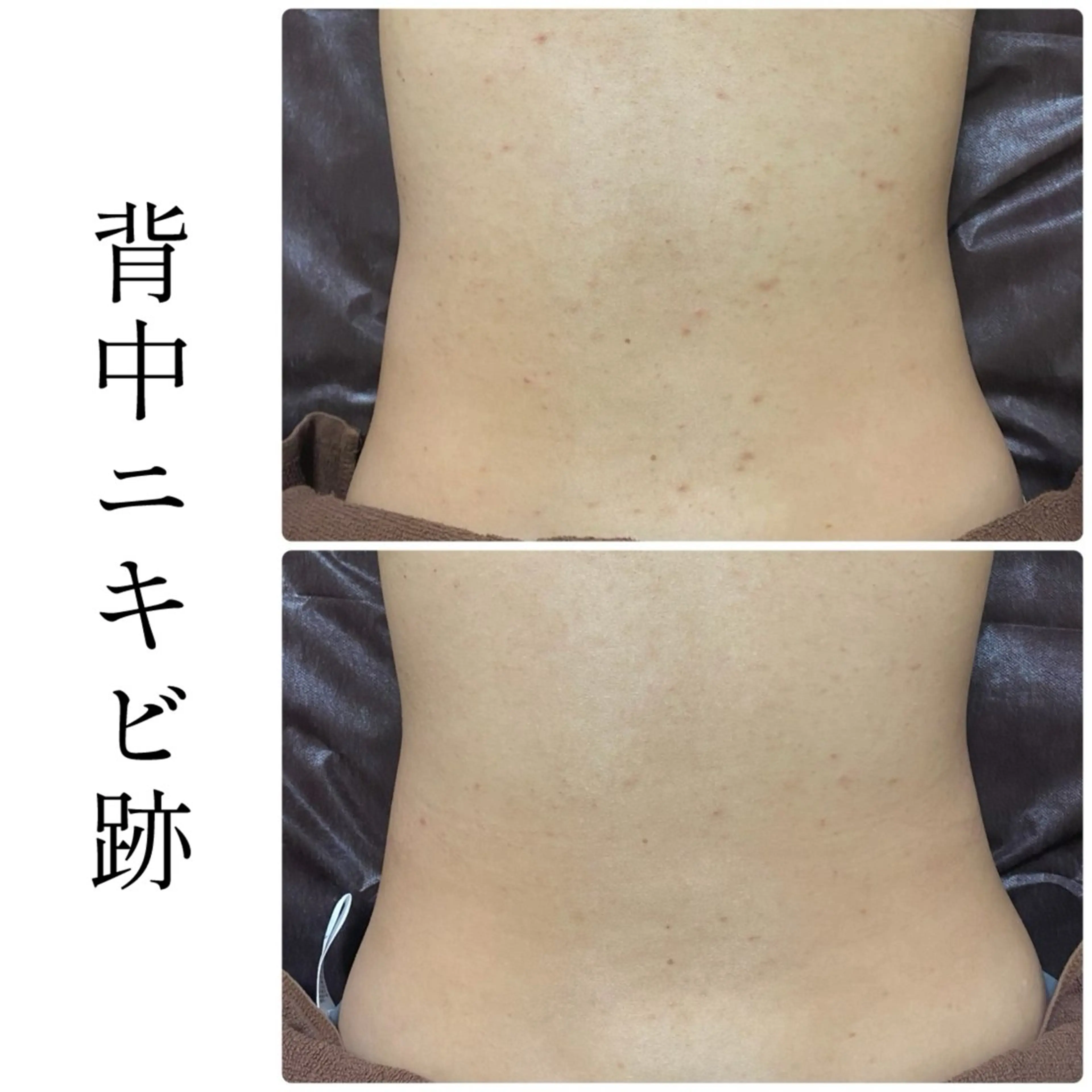 エステ ハーブピーリング専門 BIOEL横浜のエステ・リラクイメージ