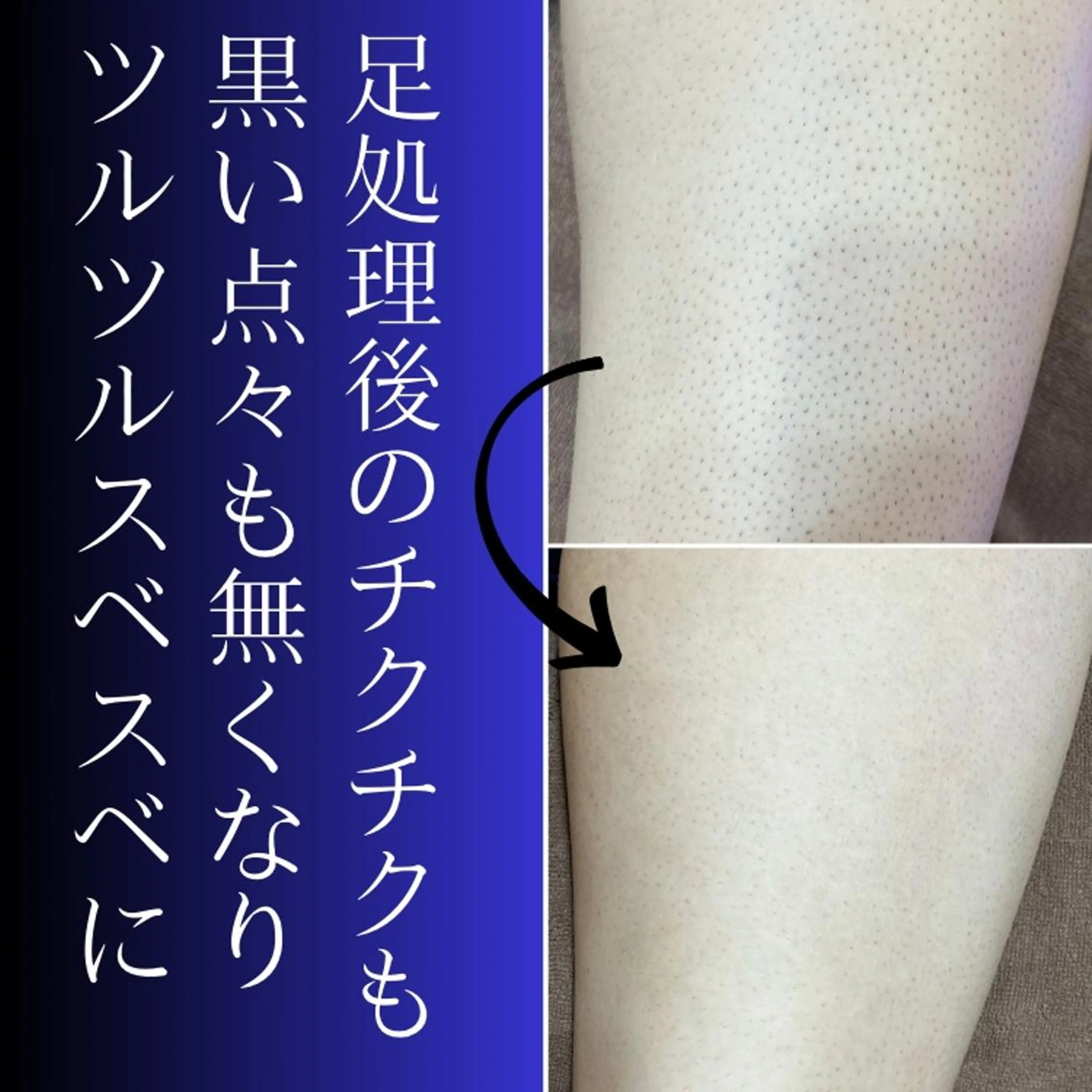 メンズ 脱毛 Sakamoto Yukiの眉毛・アイブロウイメージ