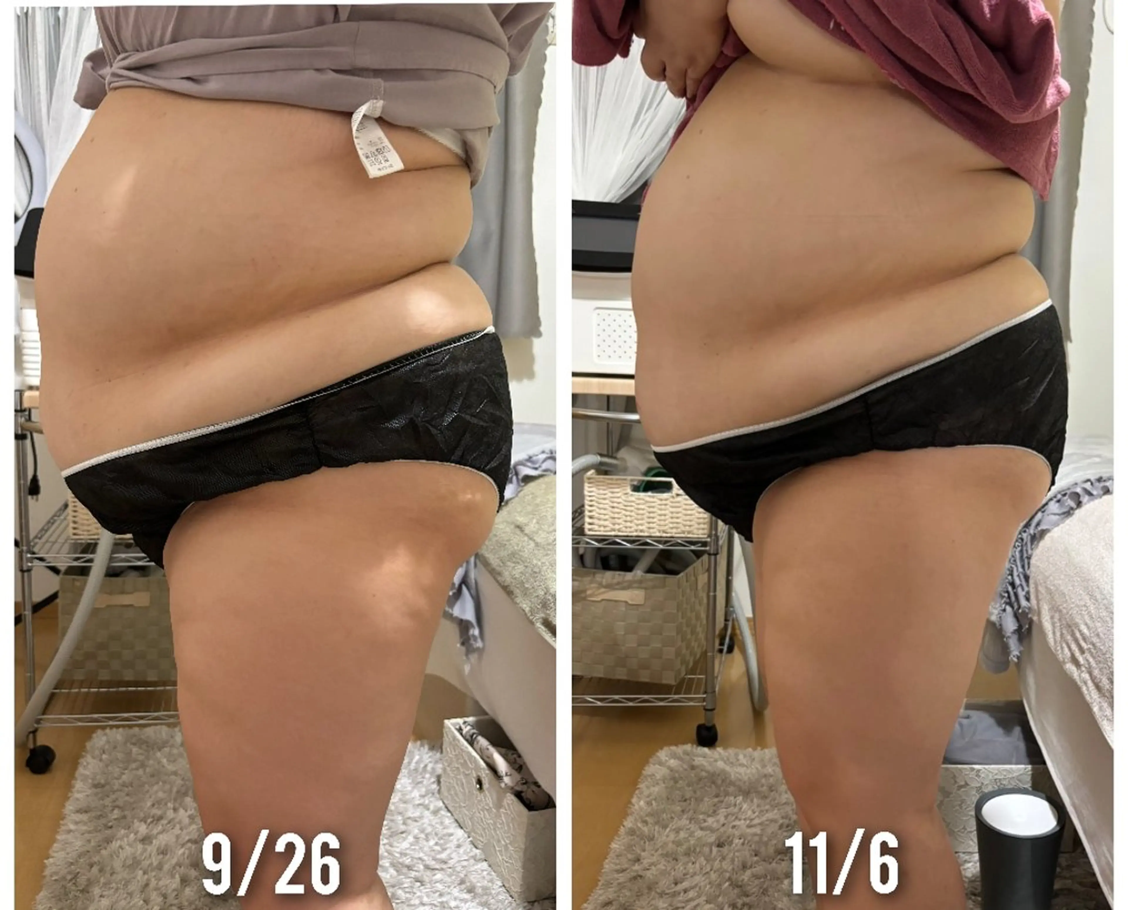 エステ Luanaまつパ脱毛 ハーブピーリング眉毛のマツエク・マツパデザイン