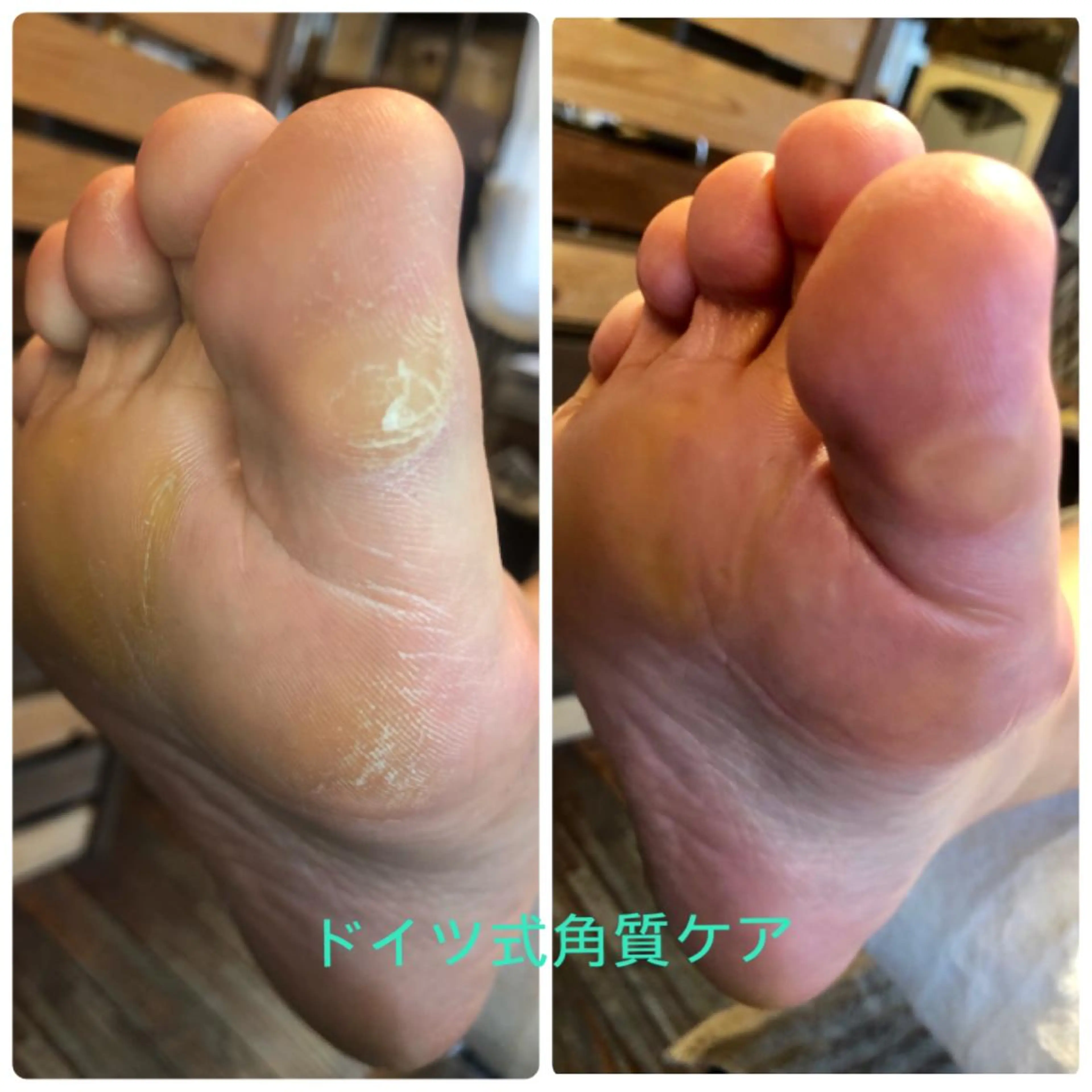 ネイル & nudge nail所属・&nudgenail 本多のネイルデザイン