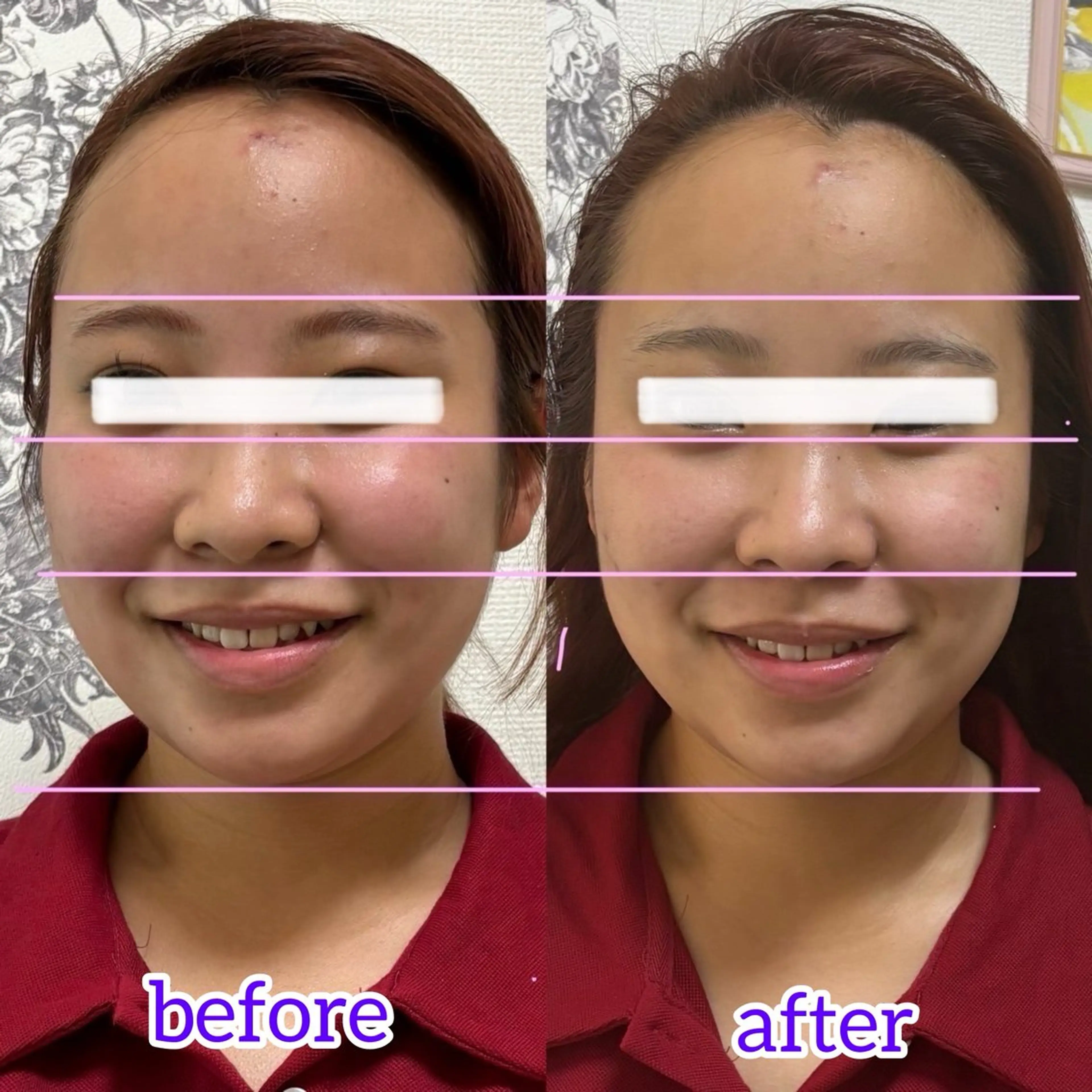 エステ リラク Linomalie エステ/たるみ/脱毛のエステ・リラクイメージ