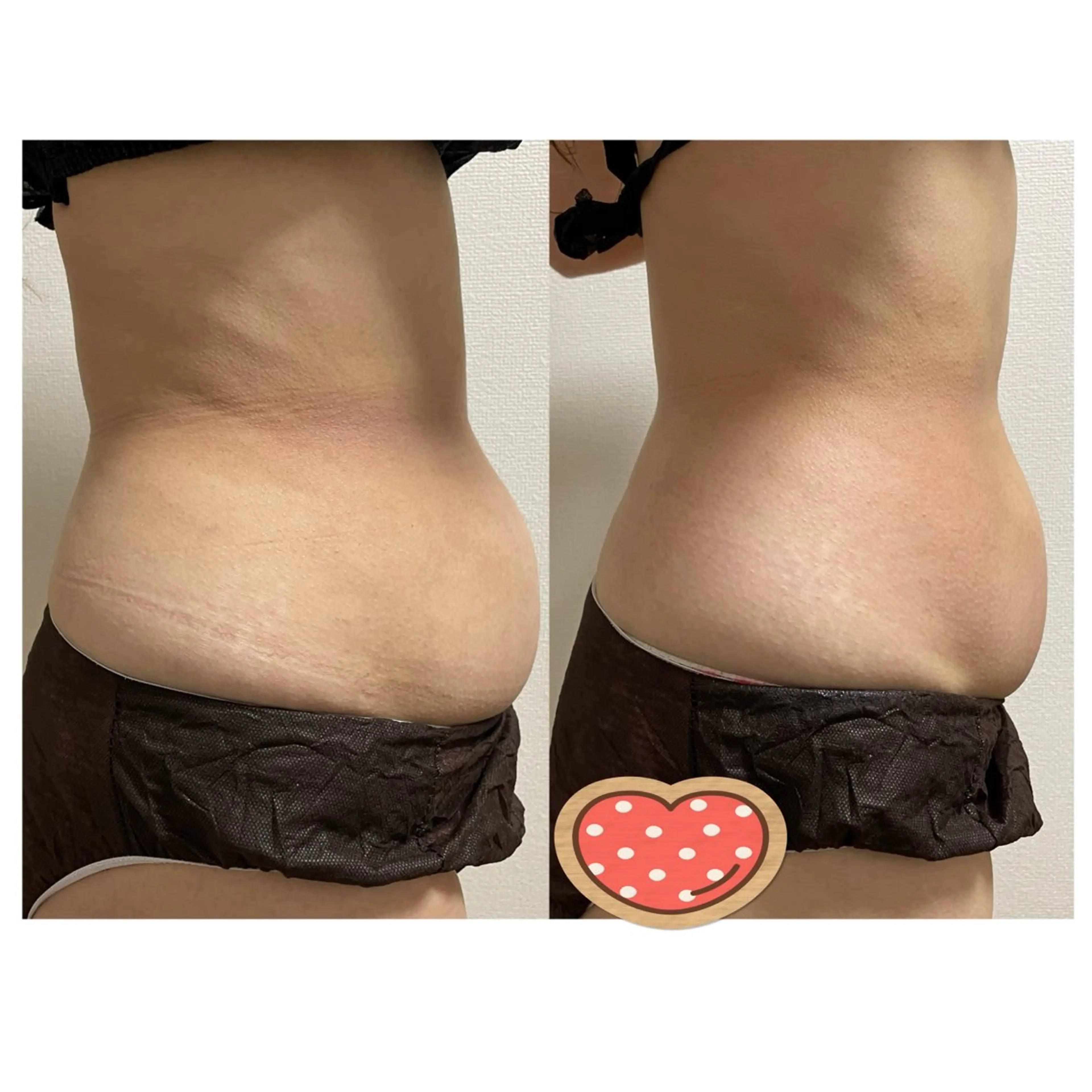 エステ 岸和田／久米田 MooMooのエステ・リラクイメージ