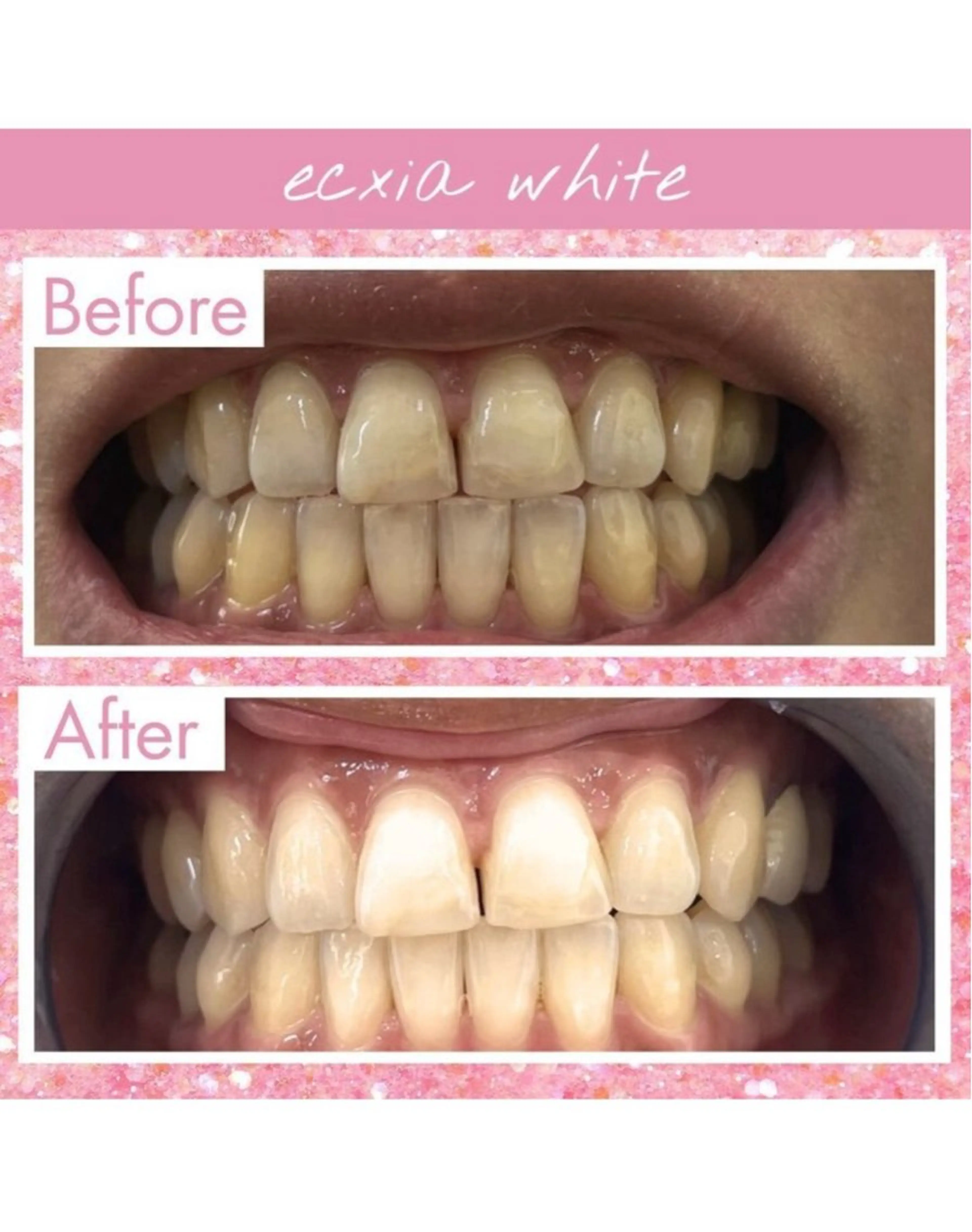 エクシアホワイト西尾 堀内恵のその他イメージ