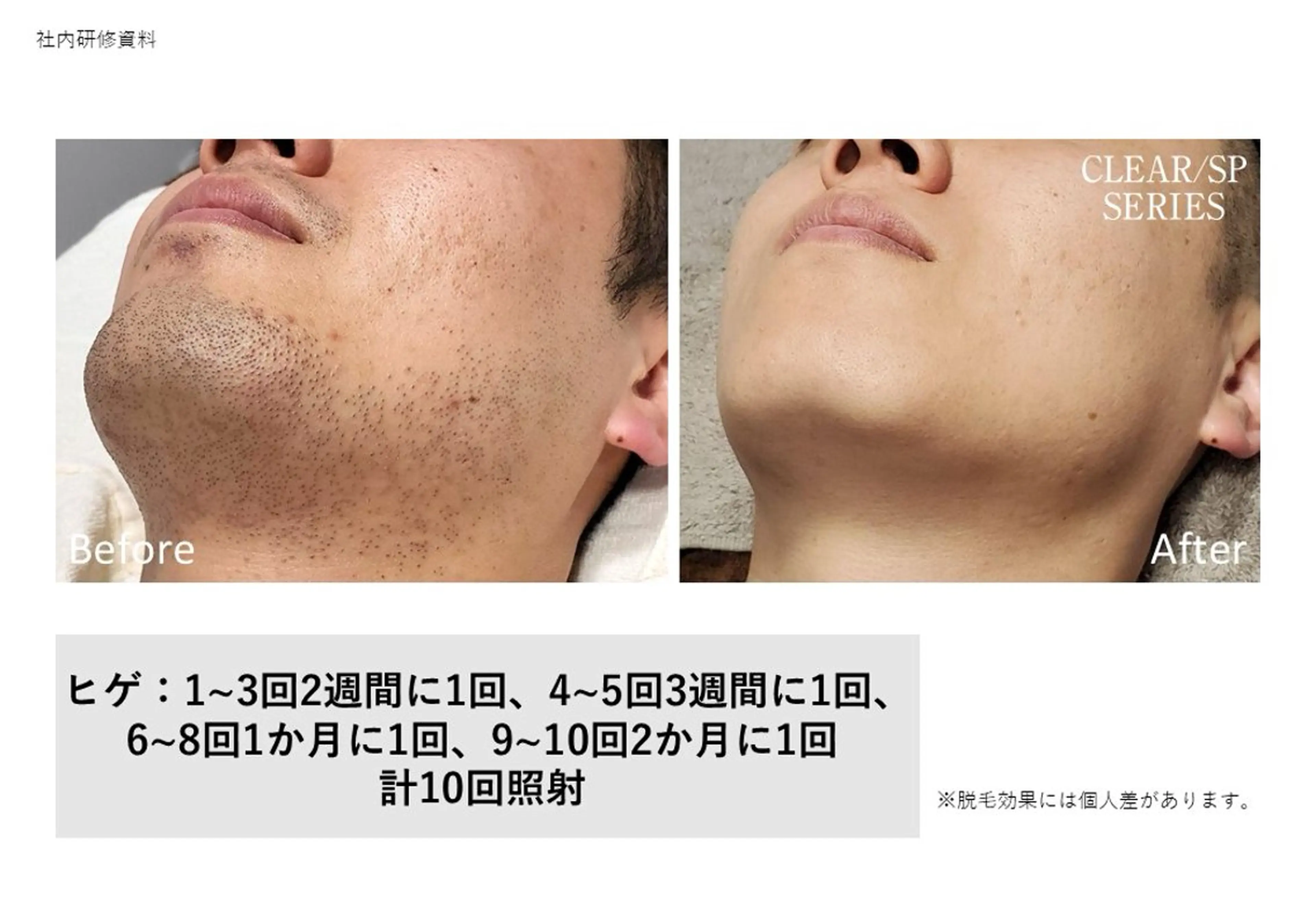 メンズ 脱毛×肌質改善 M Mondoのエステ・リラクイメージ