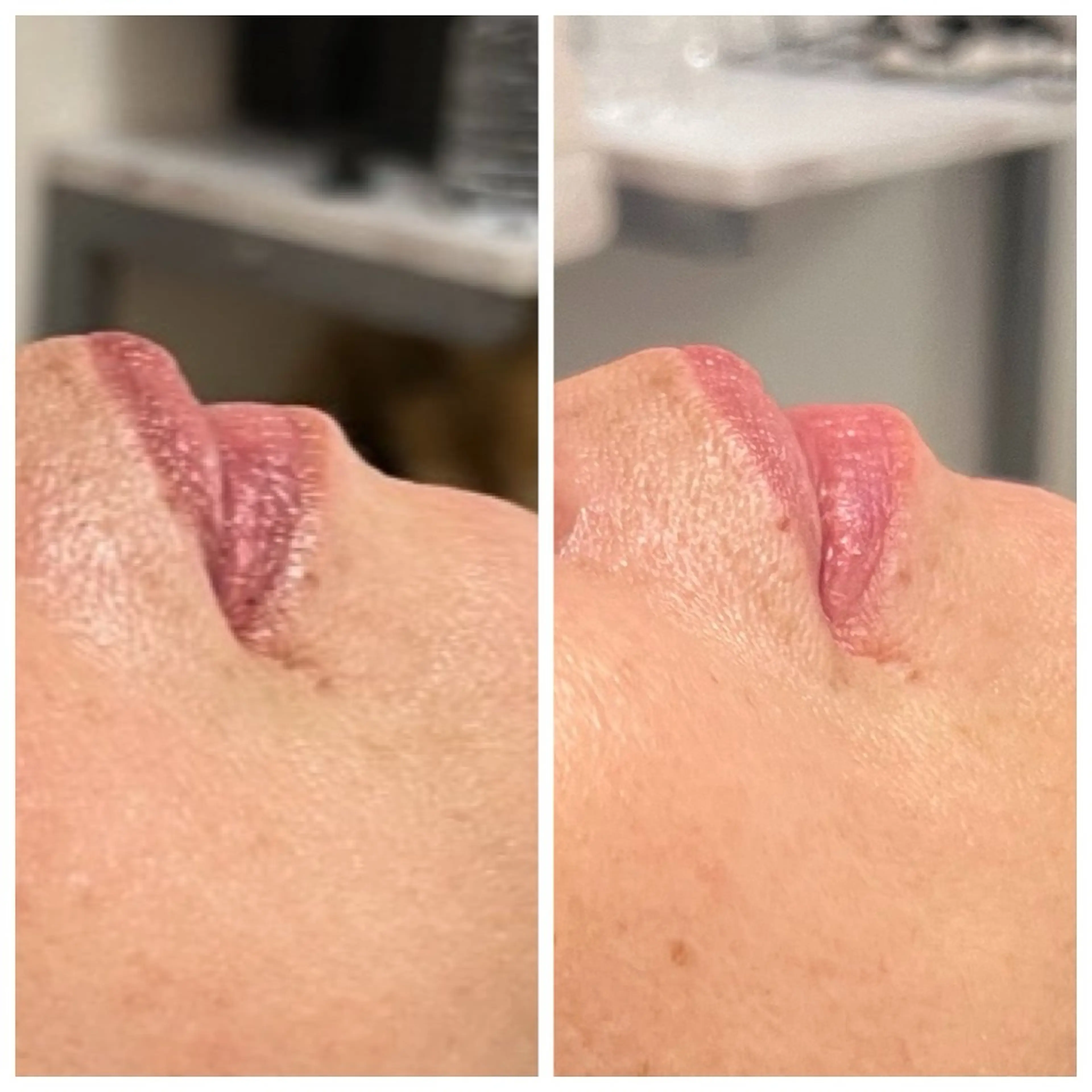 Raviy 【痩身・韓国肌管理】のエステ・リラクイメージ