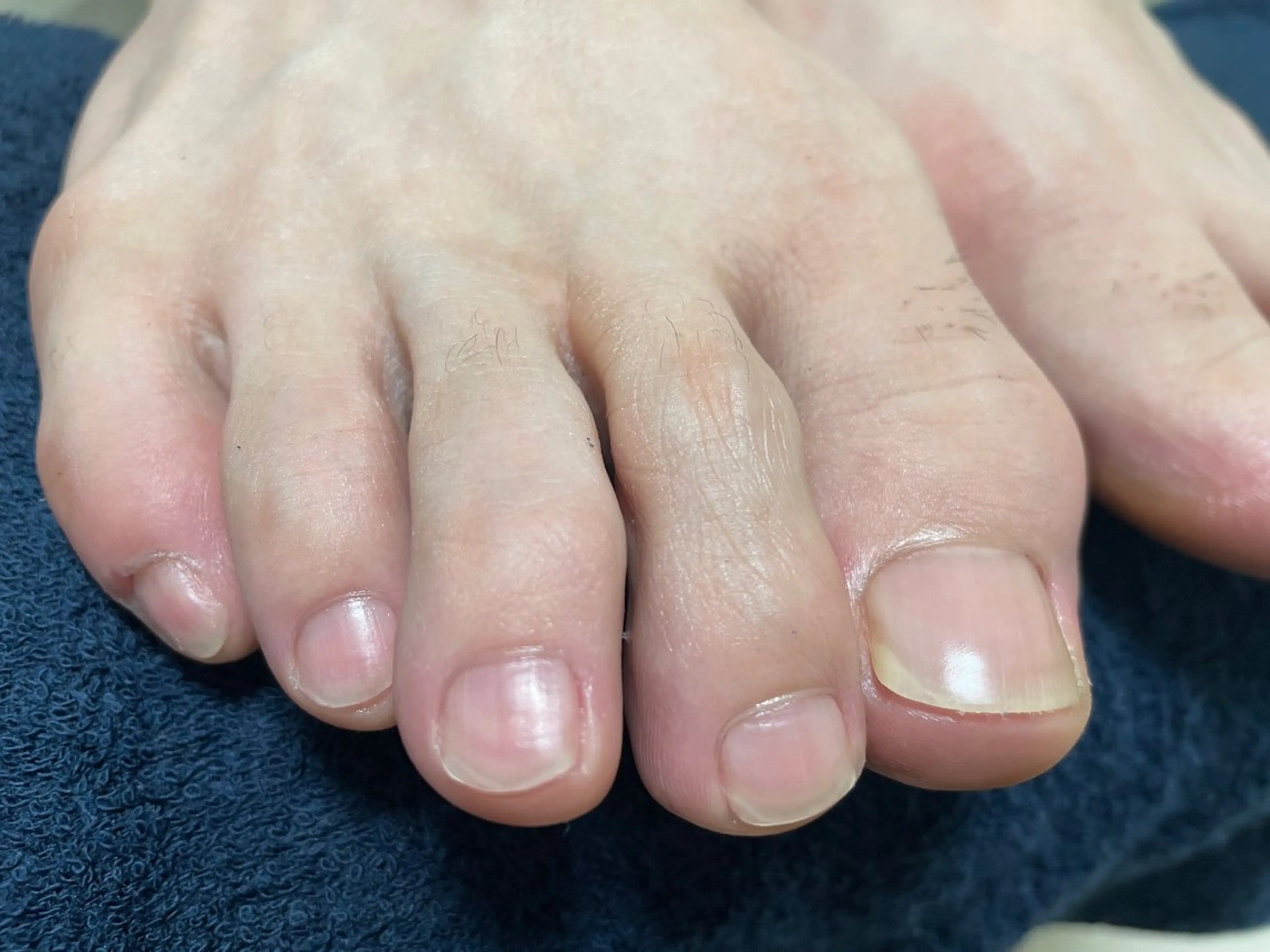 ネイル フットネイル フットネイル トータルビューティvivie(ビビィ)所属・たちばな ✋🦶💆‍♀️のネイルデザイン