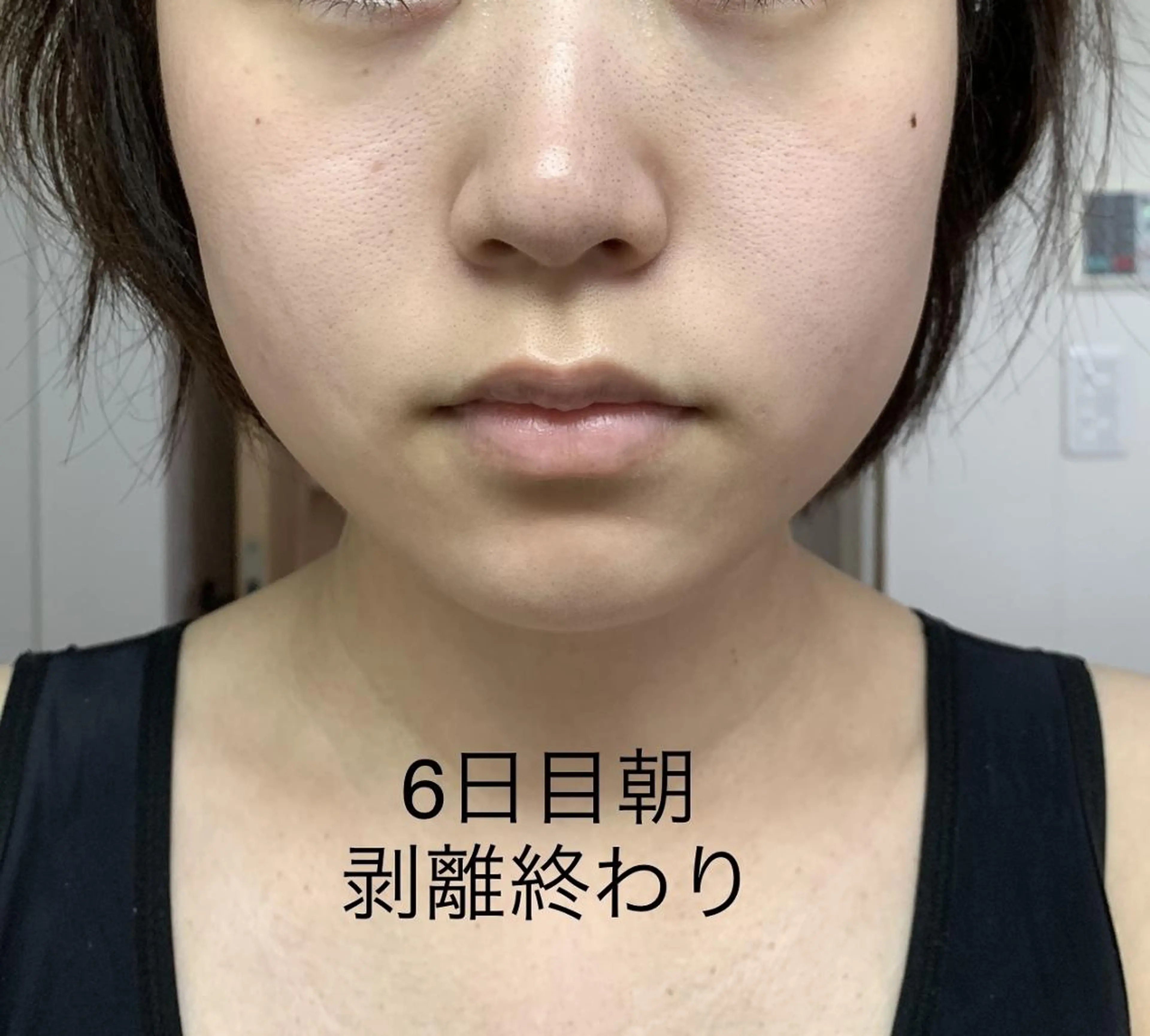 エステ リラク U24限定クーポン レイビス池袋MANAのエステ・リラクイメージ