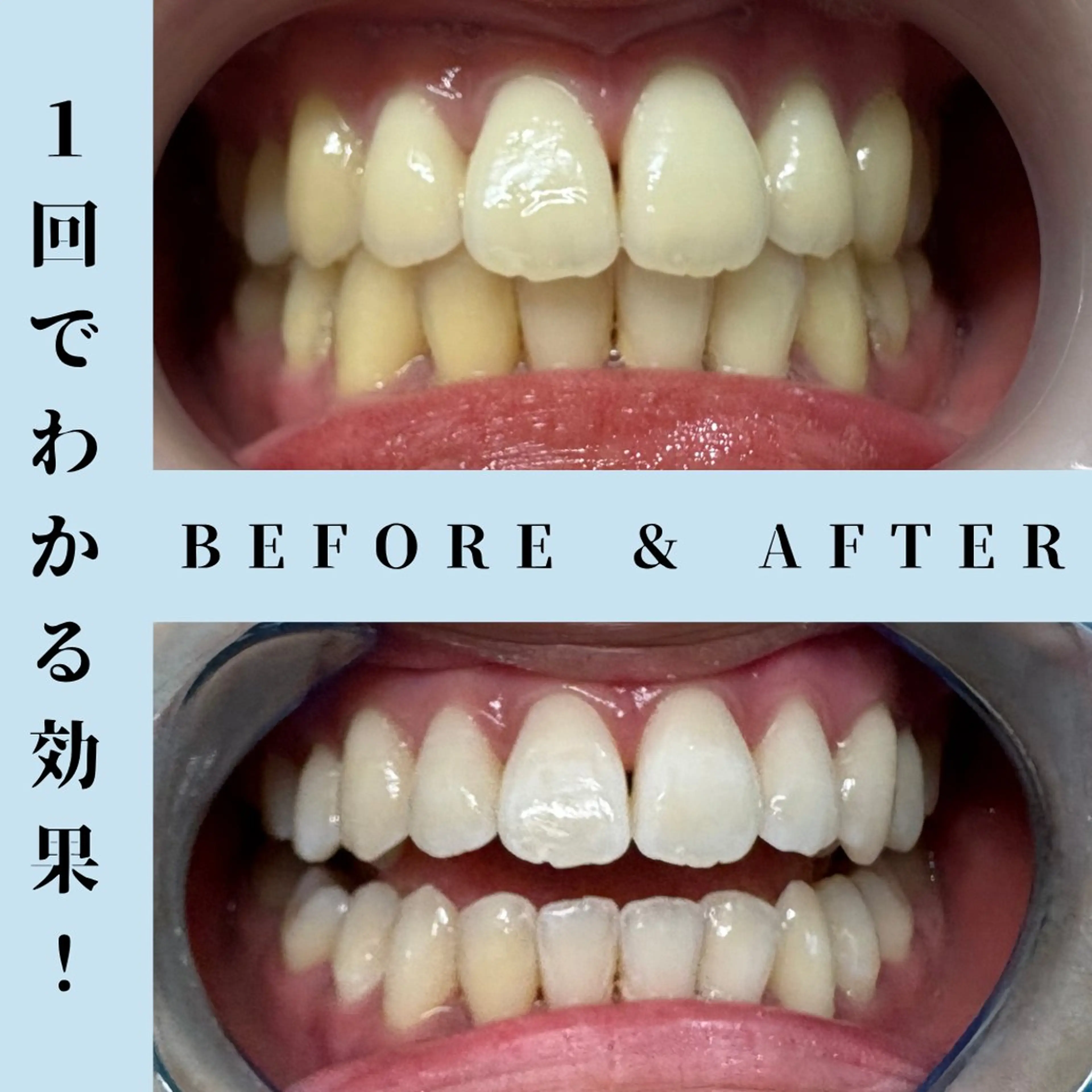 その他 セルフホワイトニング Dolce水戸店のその他イメージ