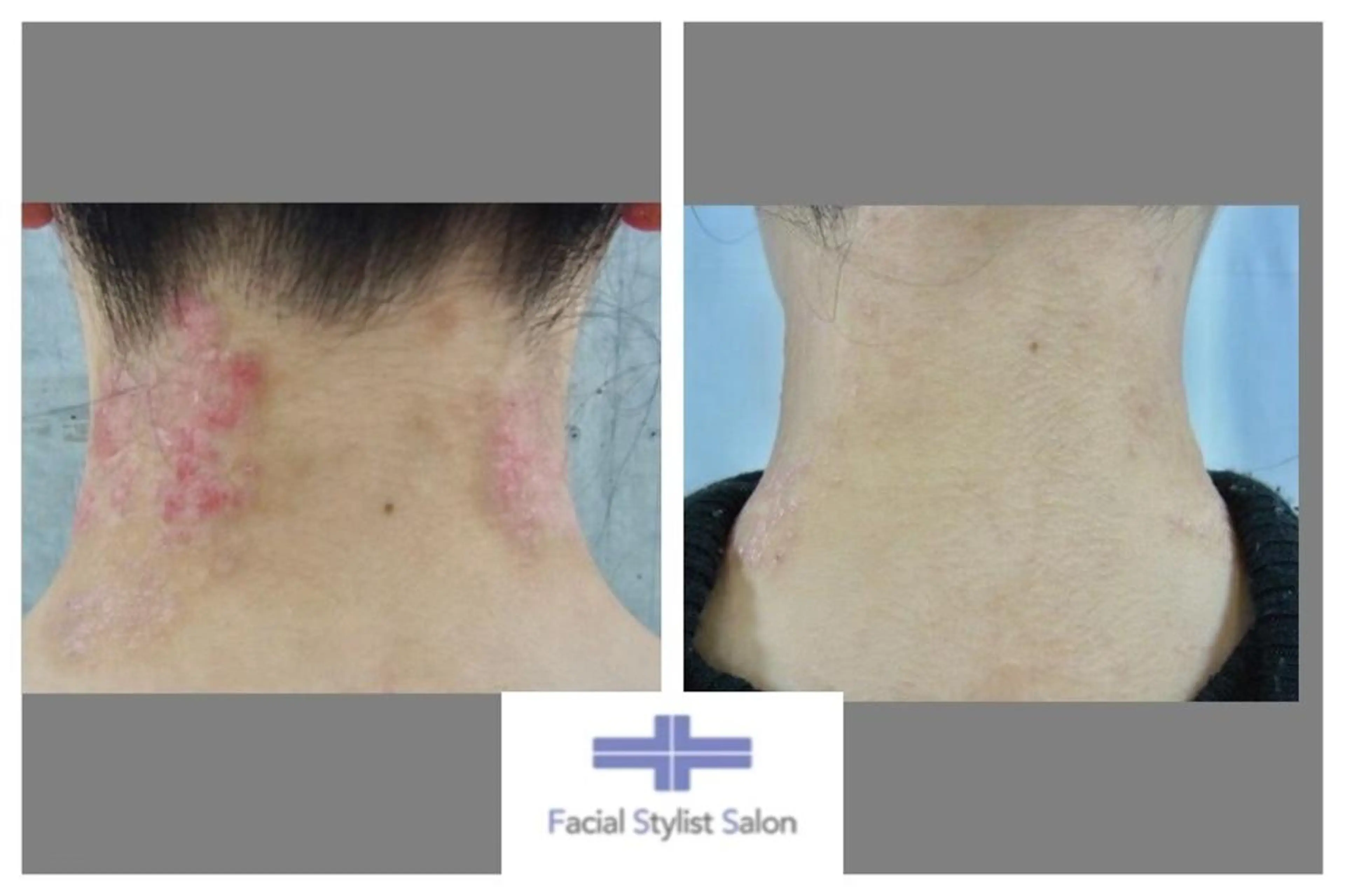 肌質改善専門サロン ／FSS渋谷店　松本のエステ・リラクイメージ