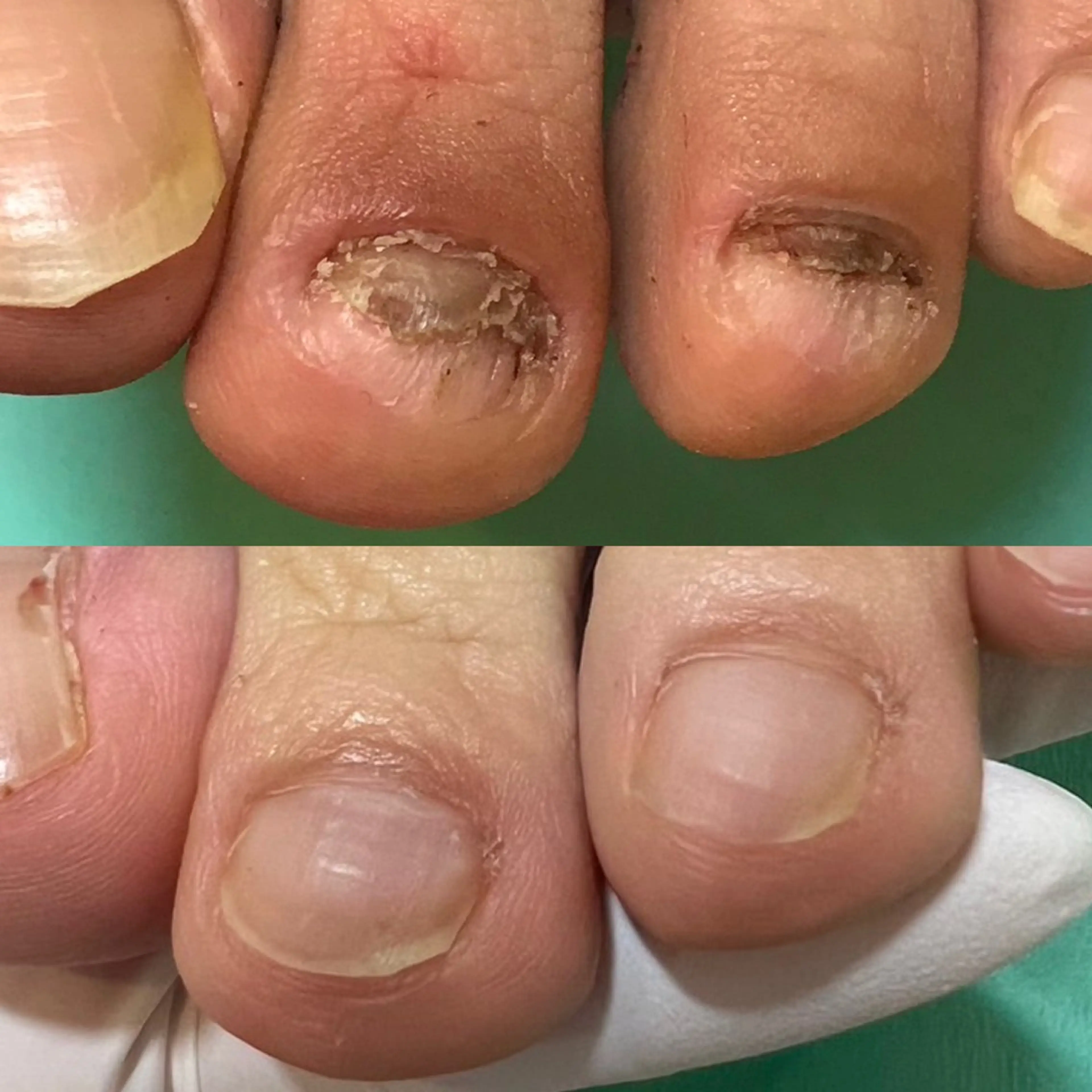 ネイル 東京巻き爪アカデミー所属・東京巻き爪 アカデミーのエステ・リラクイメージ