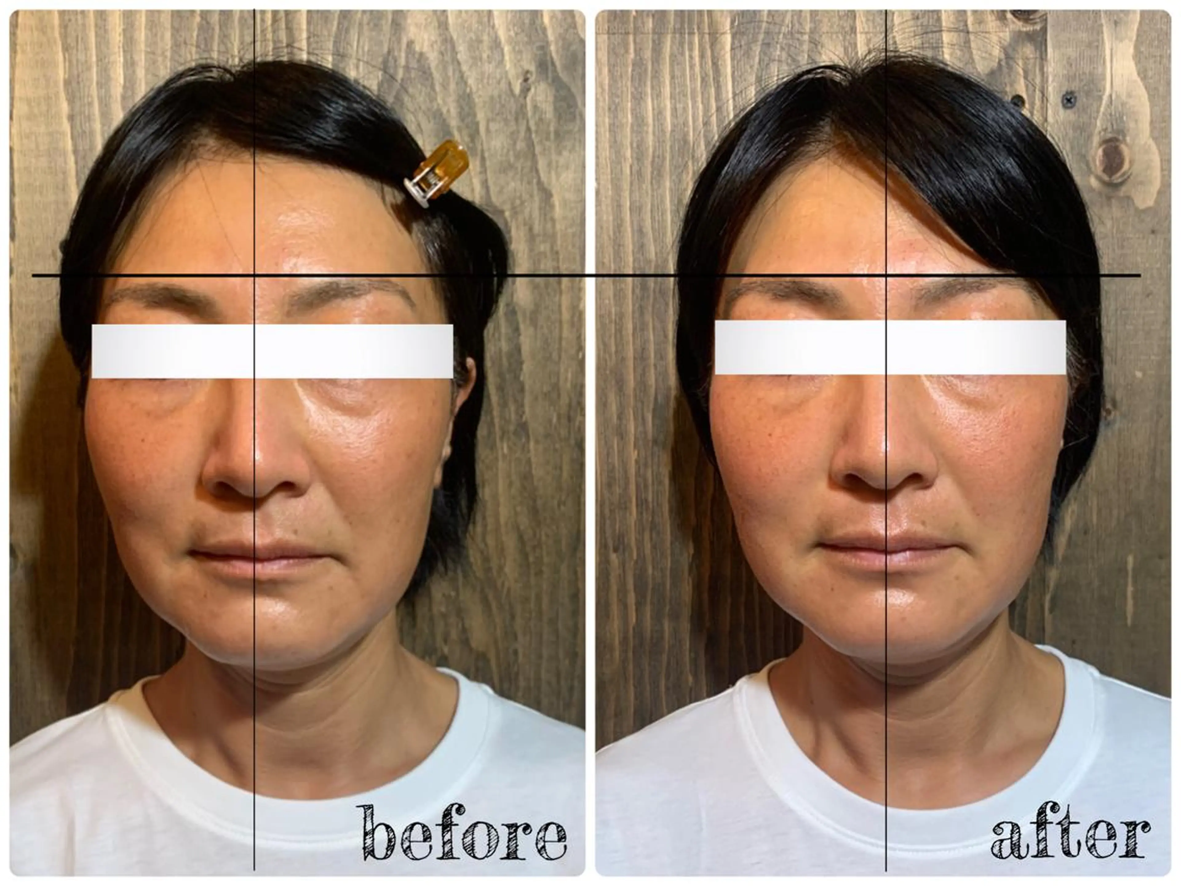 エステ リラク 💎後悔させない小顔 矯正💎イトヤマ🌱のエステ・リラクイメージ