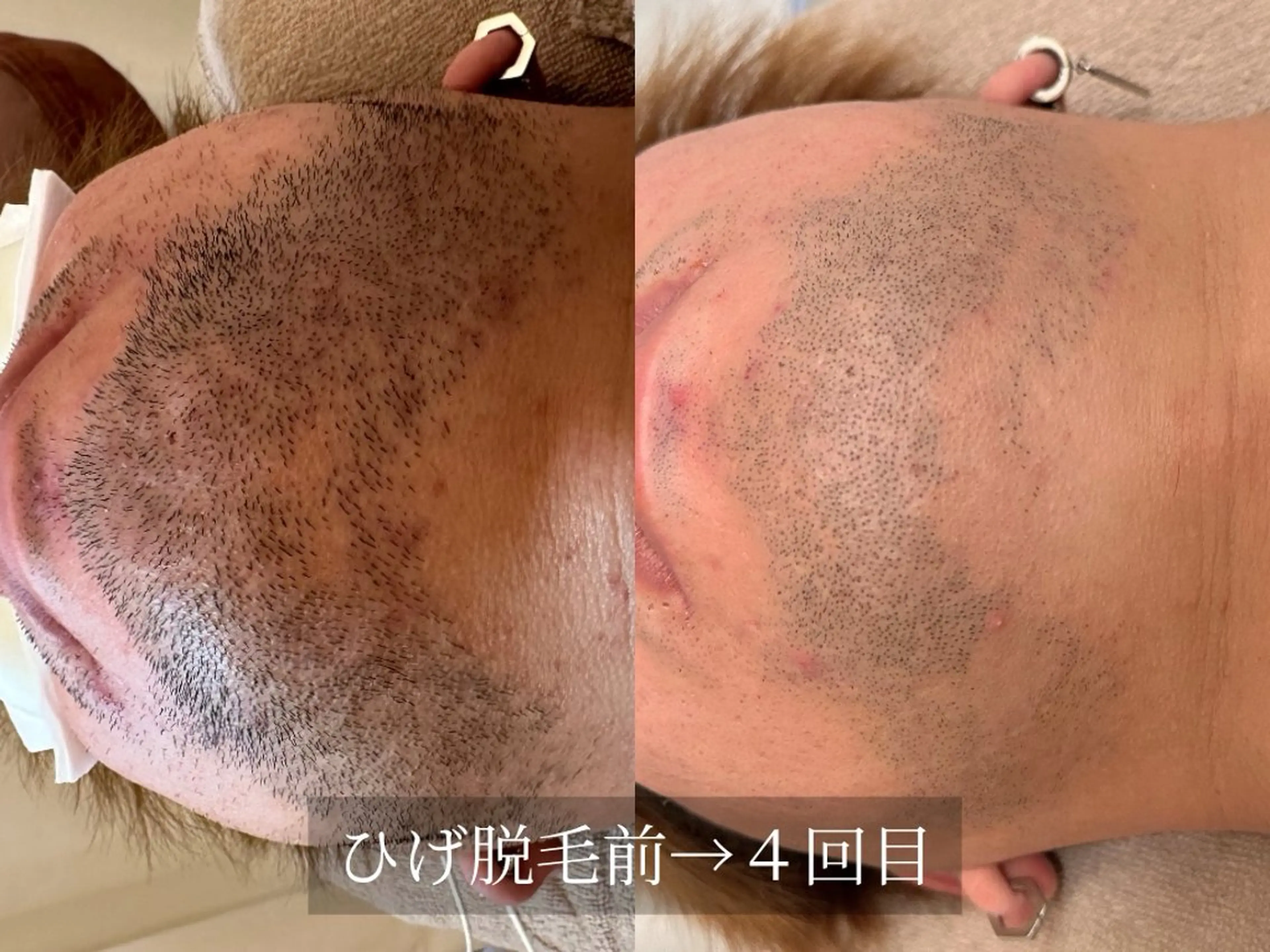 プライベート脱毛サロン　Arum所属・脱毛サロン Arumのエステ・リラクイメージ