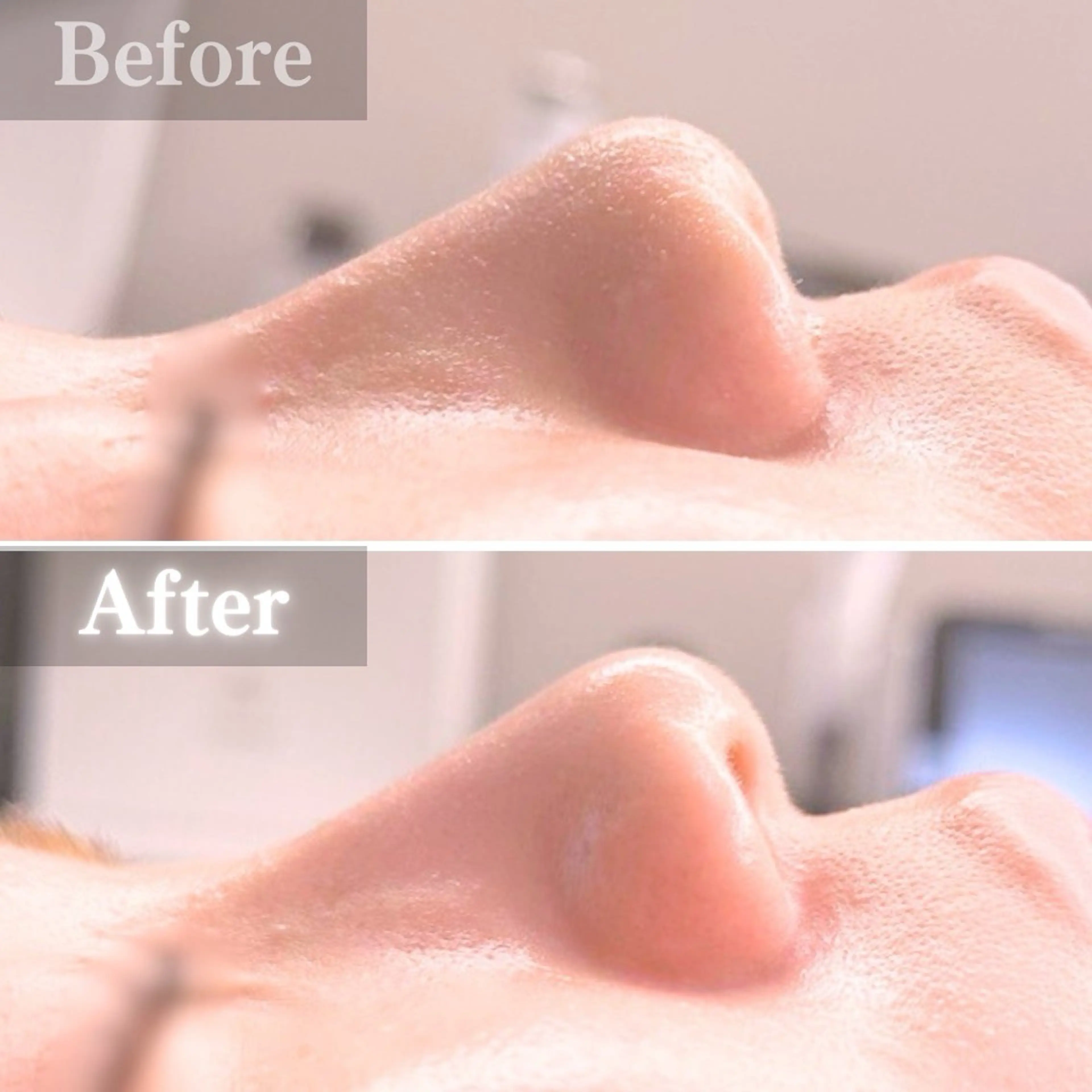 エステ 毛穴洗浄特化🫧 オオツカのエステ・リラクイメージ