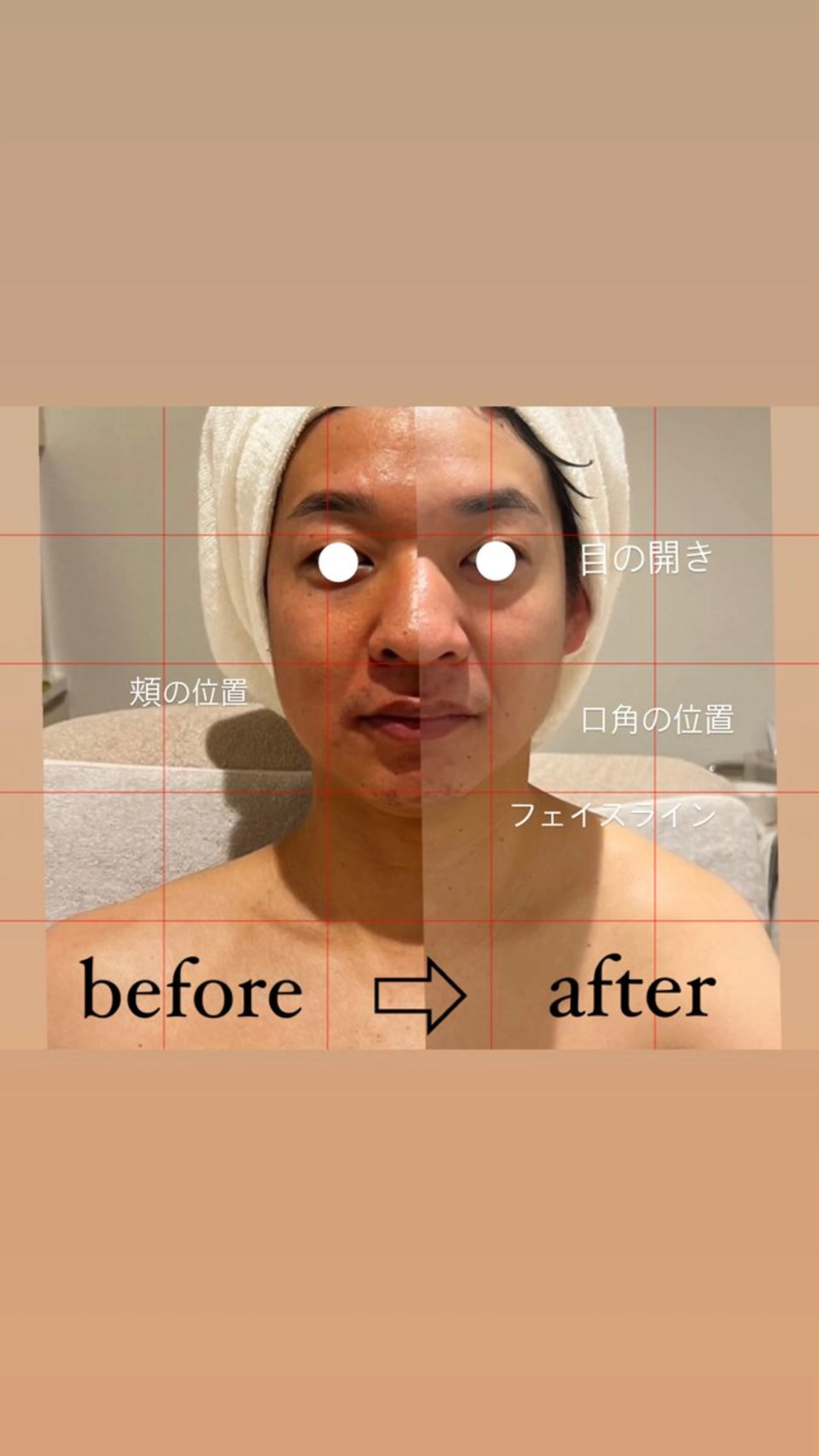 肌分析×パーソナル エステPOLAのその他イメージ