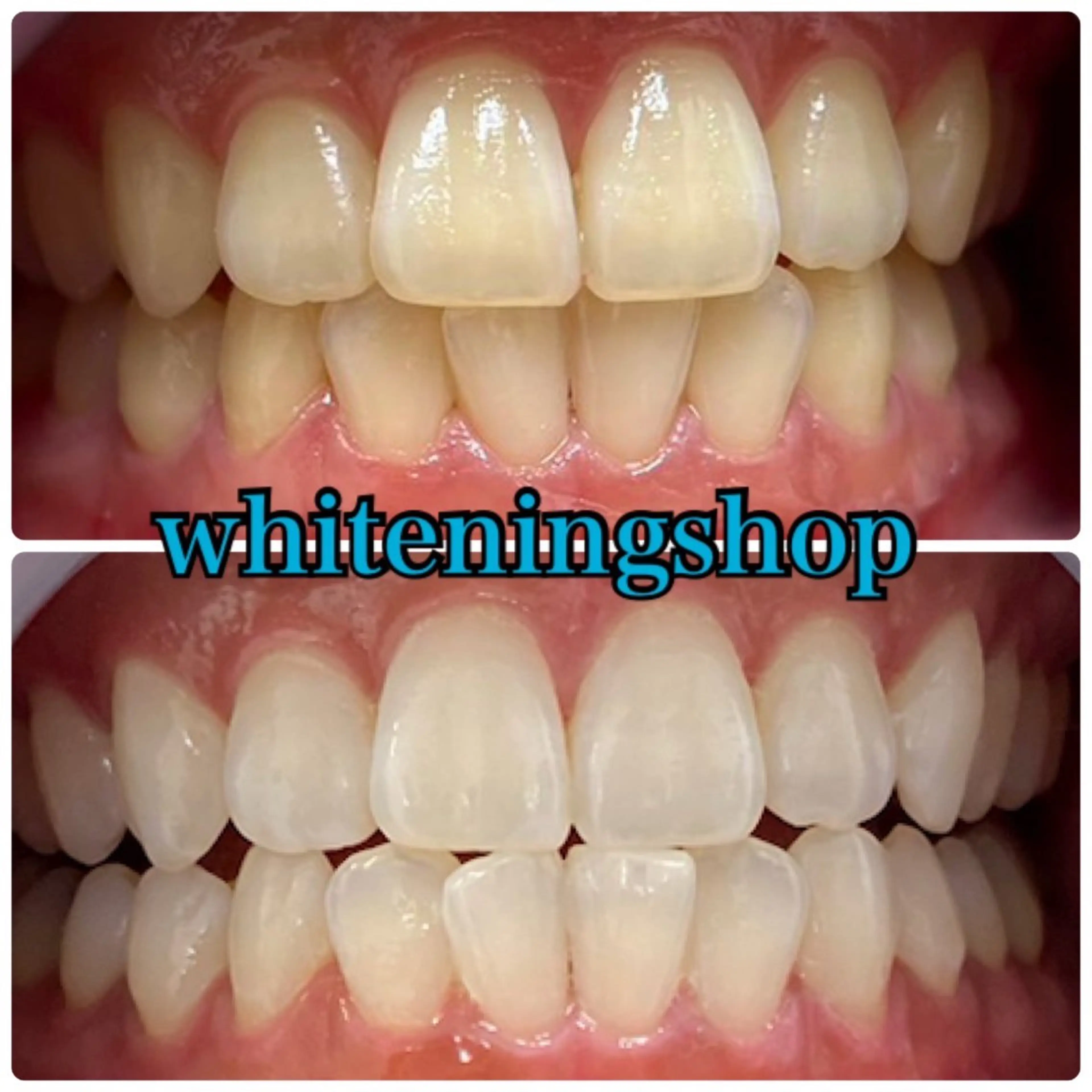 エステ リラク ホワイトニング ショップ吉祥寺店のエステ・リラクイメージ