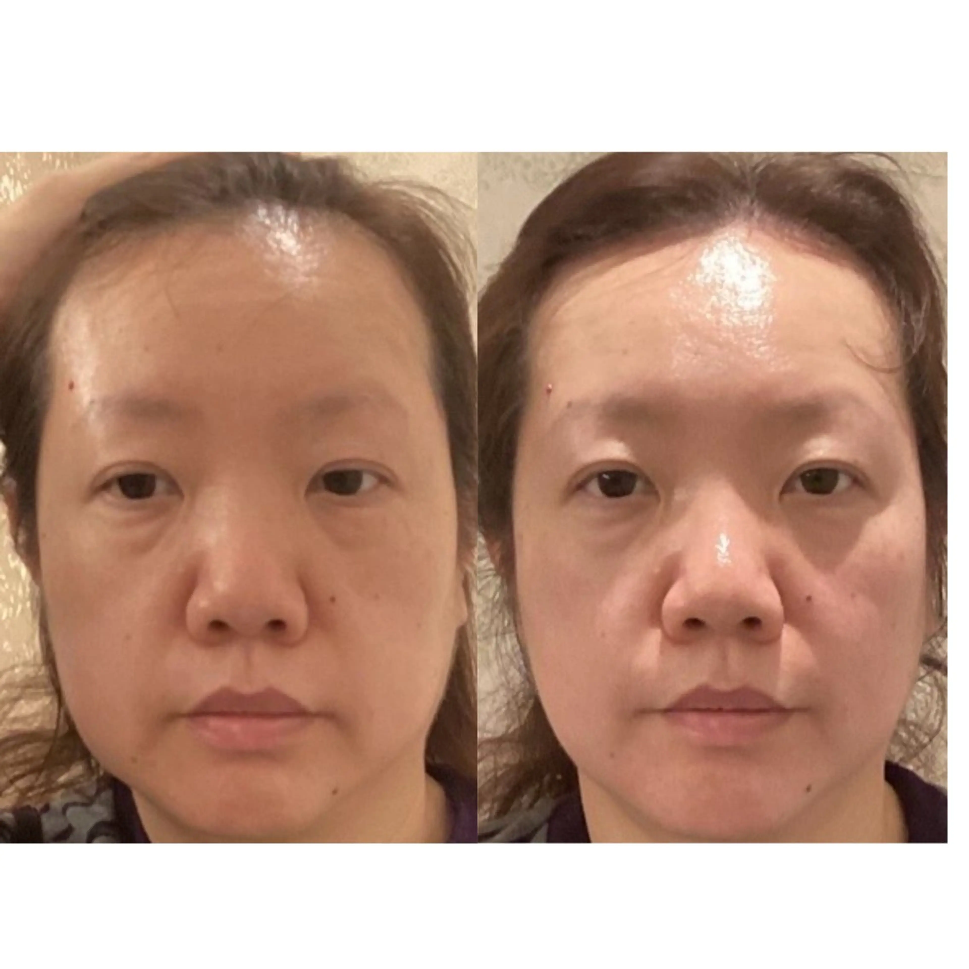 GRANVIR グランヴィールのエステ・リラクイメージ