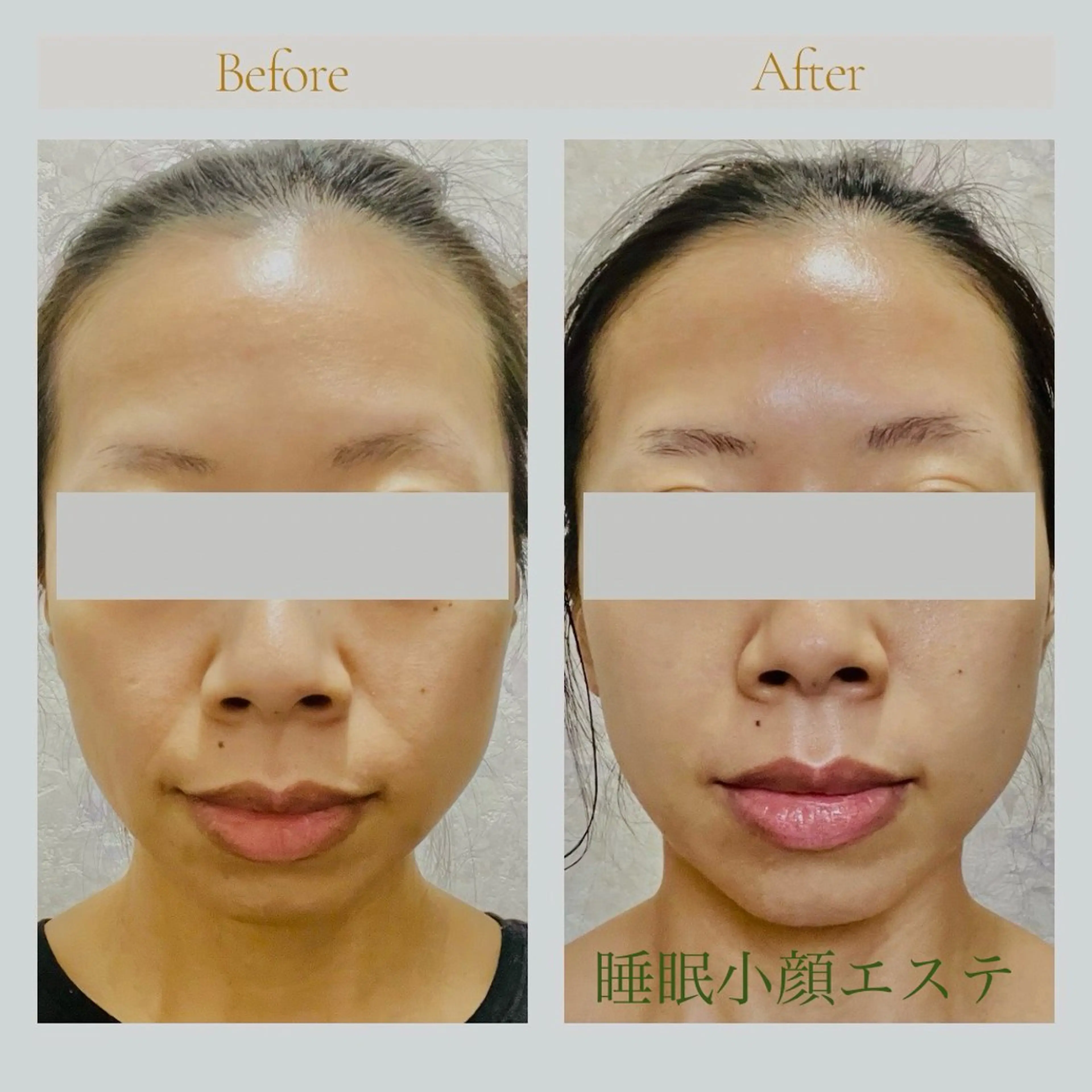 Room ルームのエステ・リラクイメージ