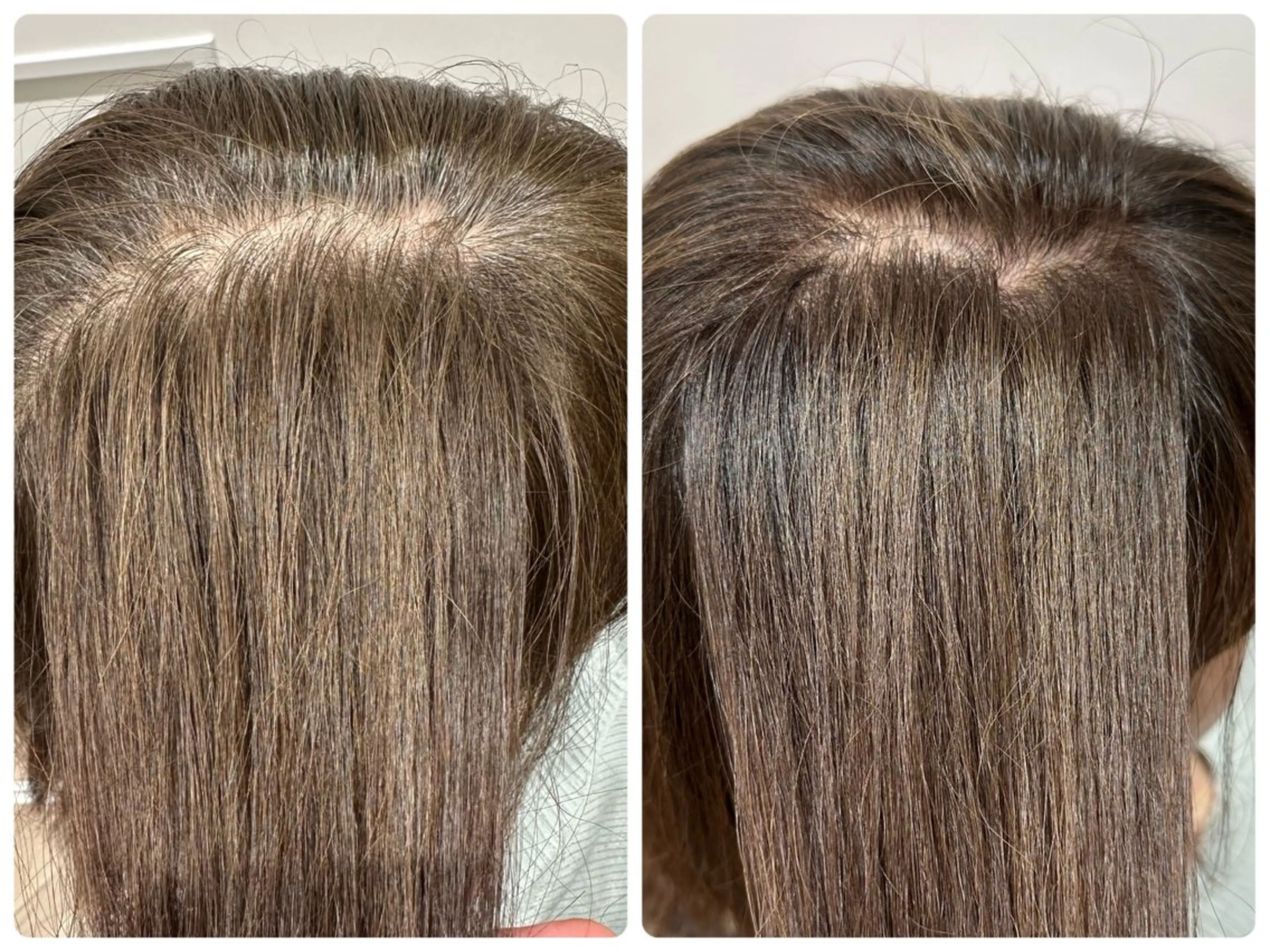 ミディアム 💠悩み解決美容師 💠シュンヤのヘアスタイル