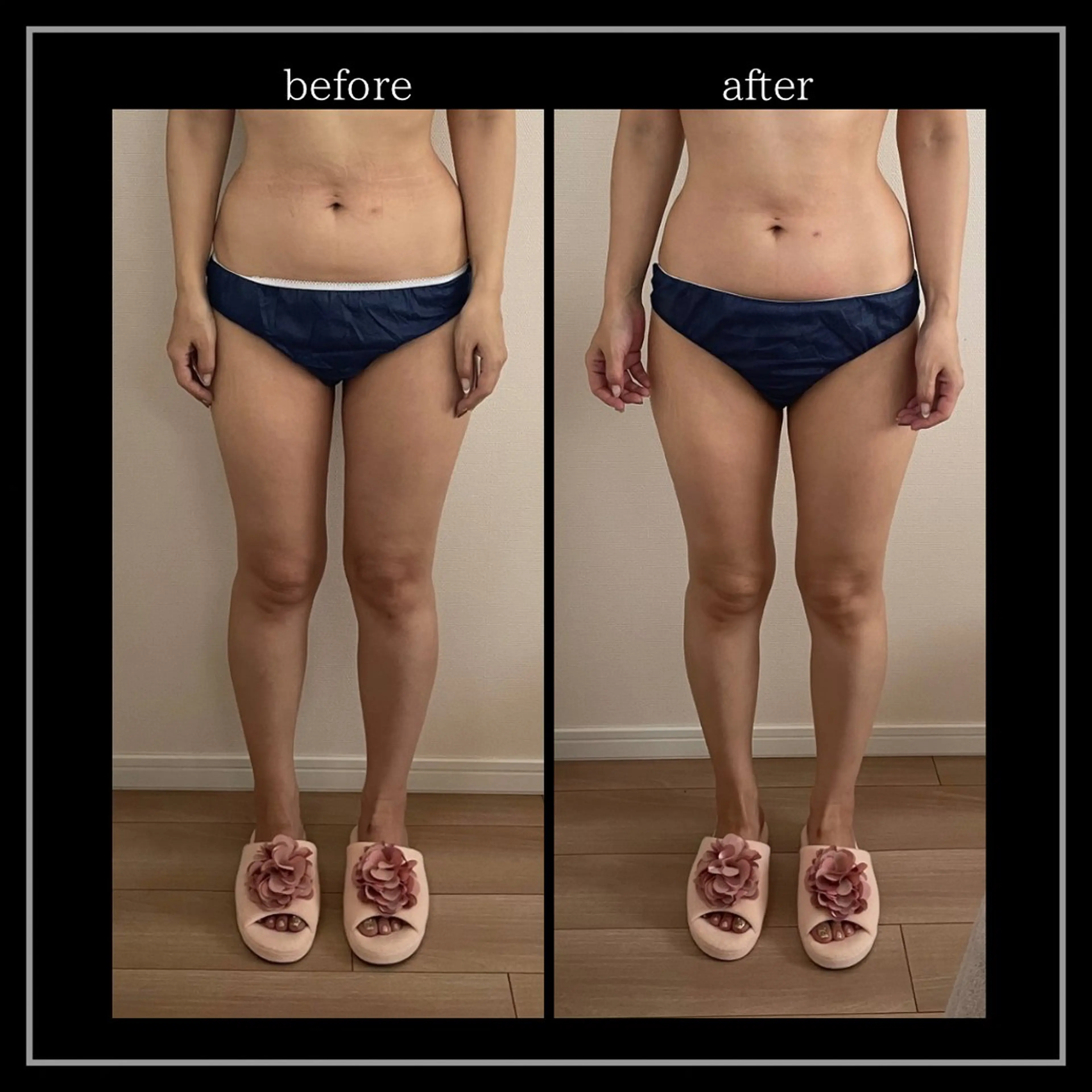 オフ:オン 全身筋膜マッサージのエステ・リラクイメージ