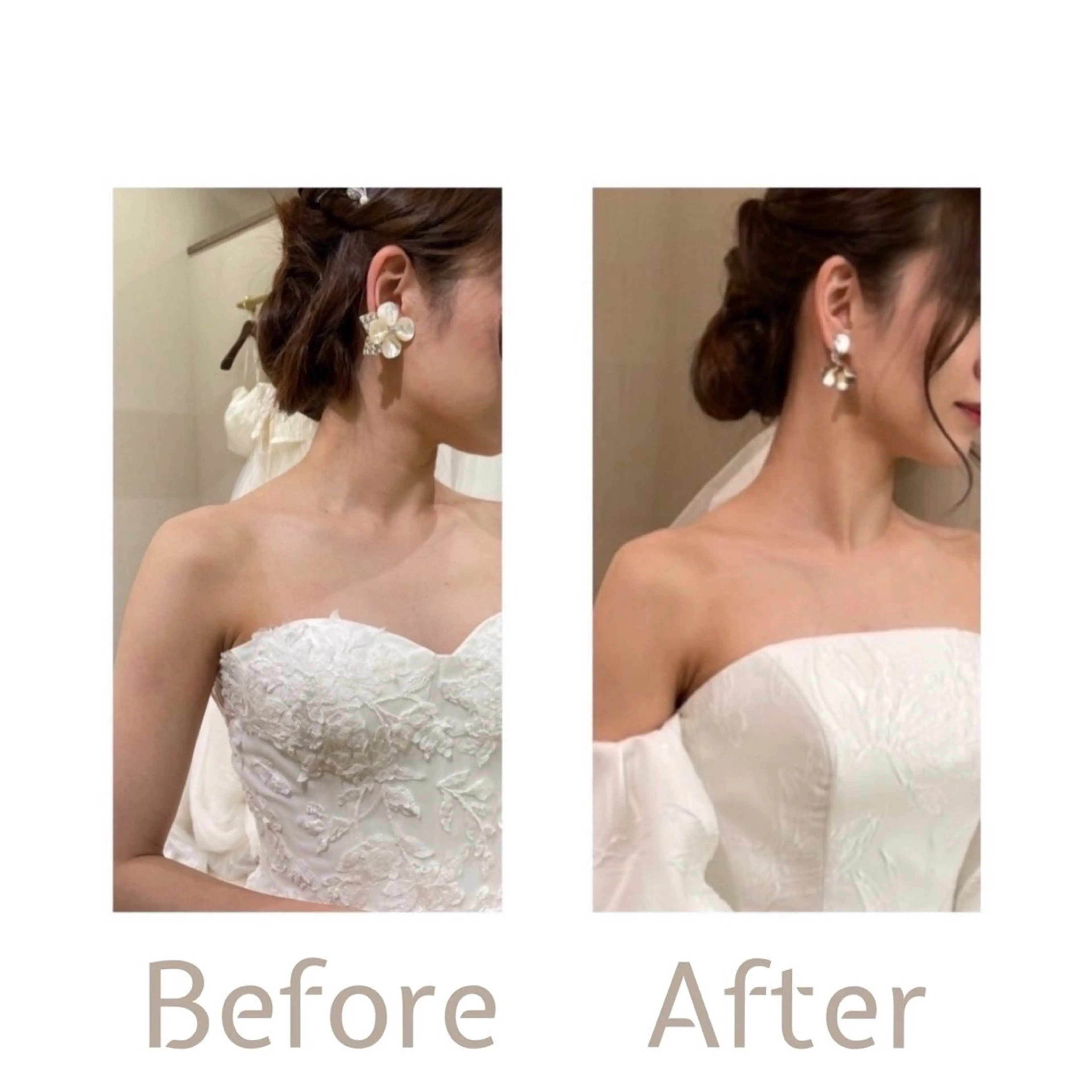 【医療提携】脱毛 小顔ハーブピーリングのエステ・リラクイメージ