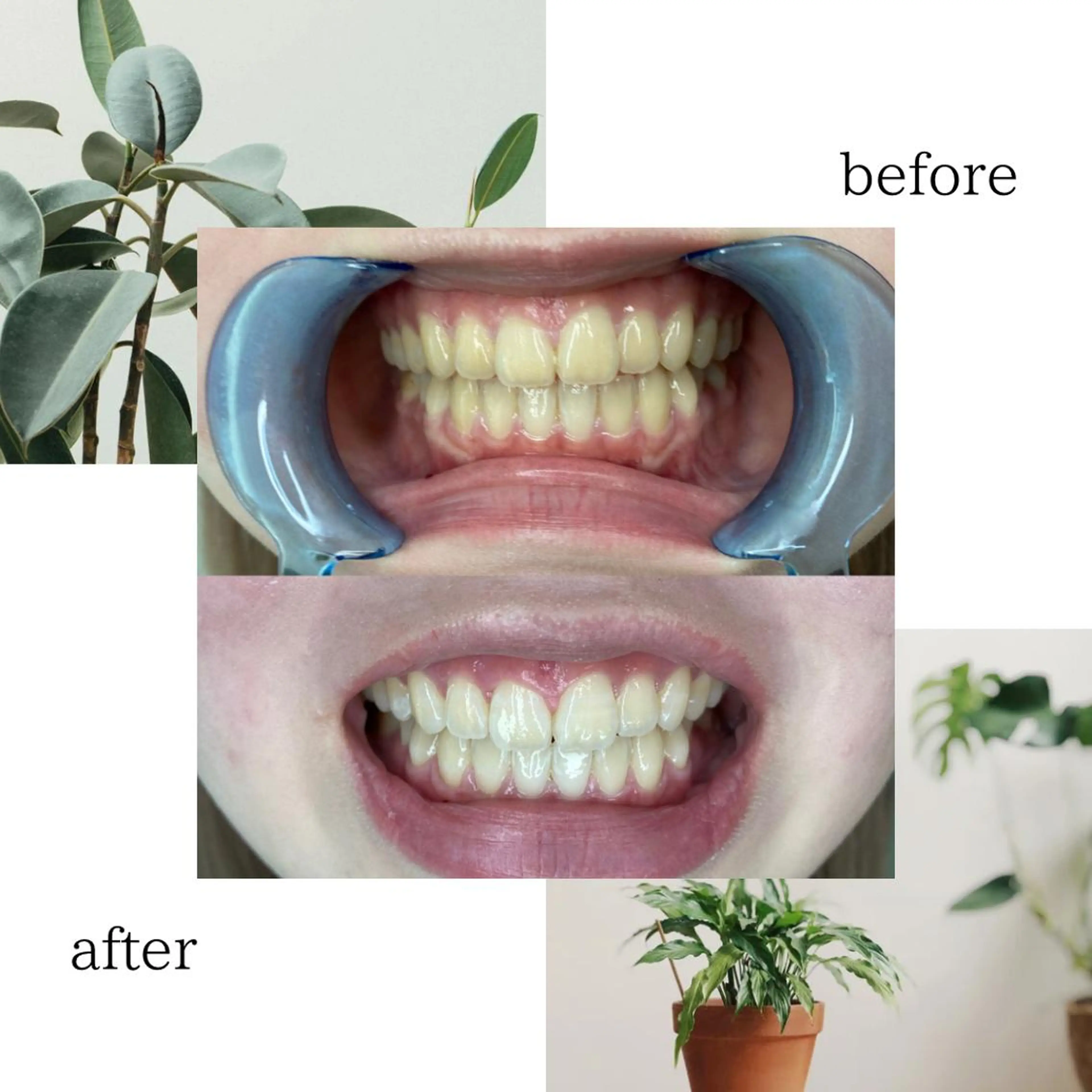 脱毛専門サロンELIXIR（ｴﾘｸｻｰ）所属・脱毛&ホワイトニング ELIXIR×ULTのエステ・リラクイメージ