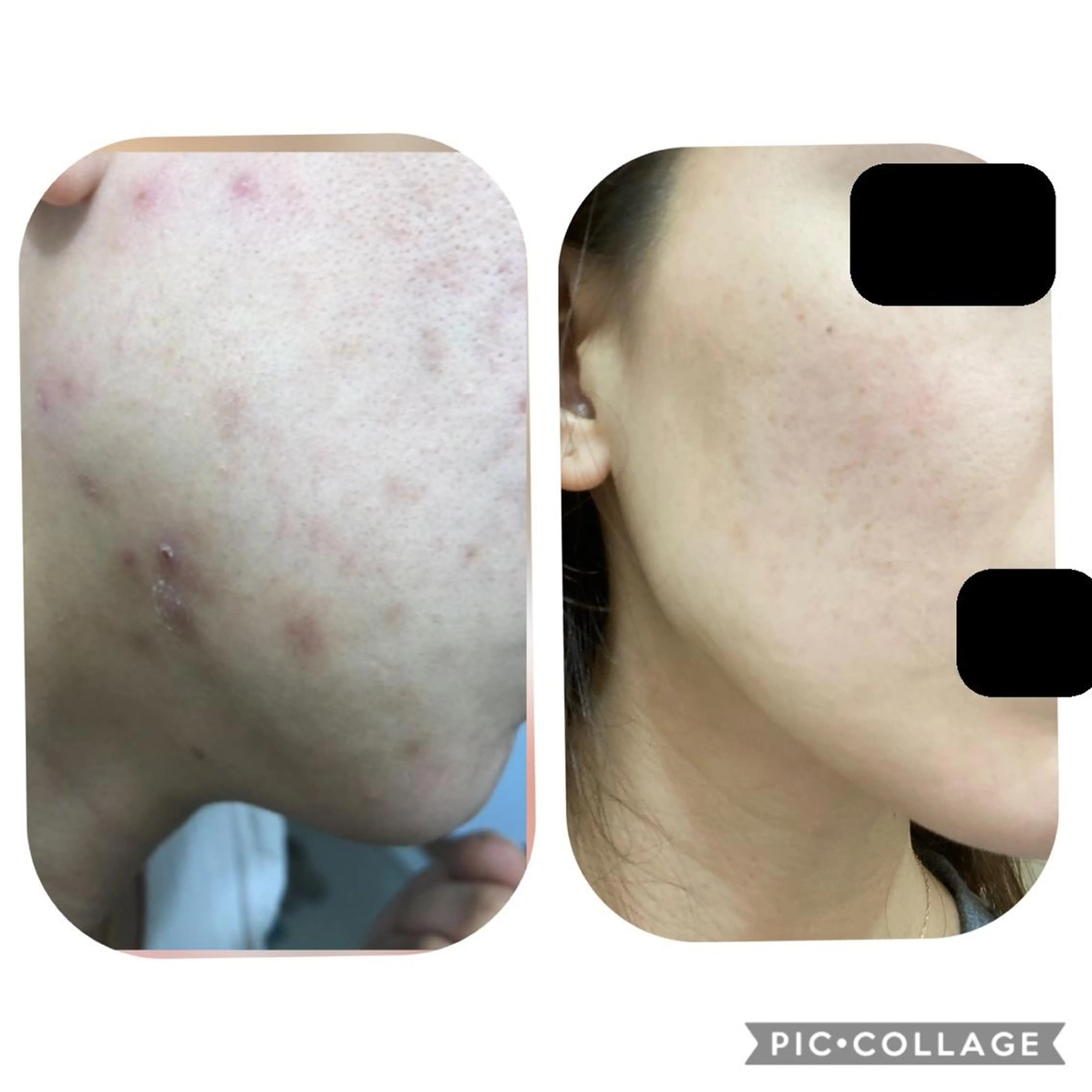 エステ リラク BeautySalonGemmy所属・Gemmy 愛美のエステ・リラクイメージ