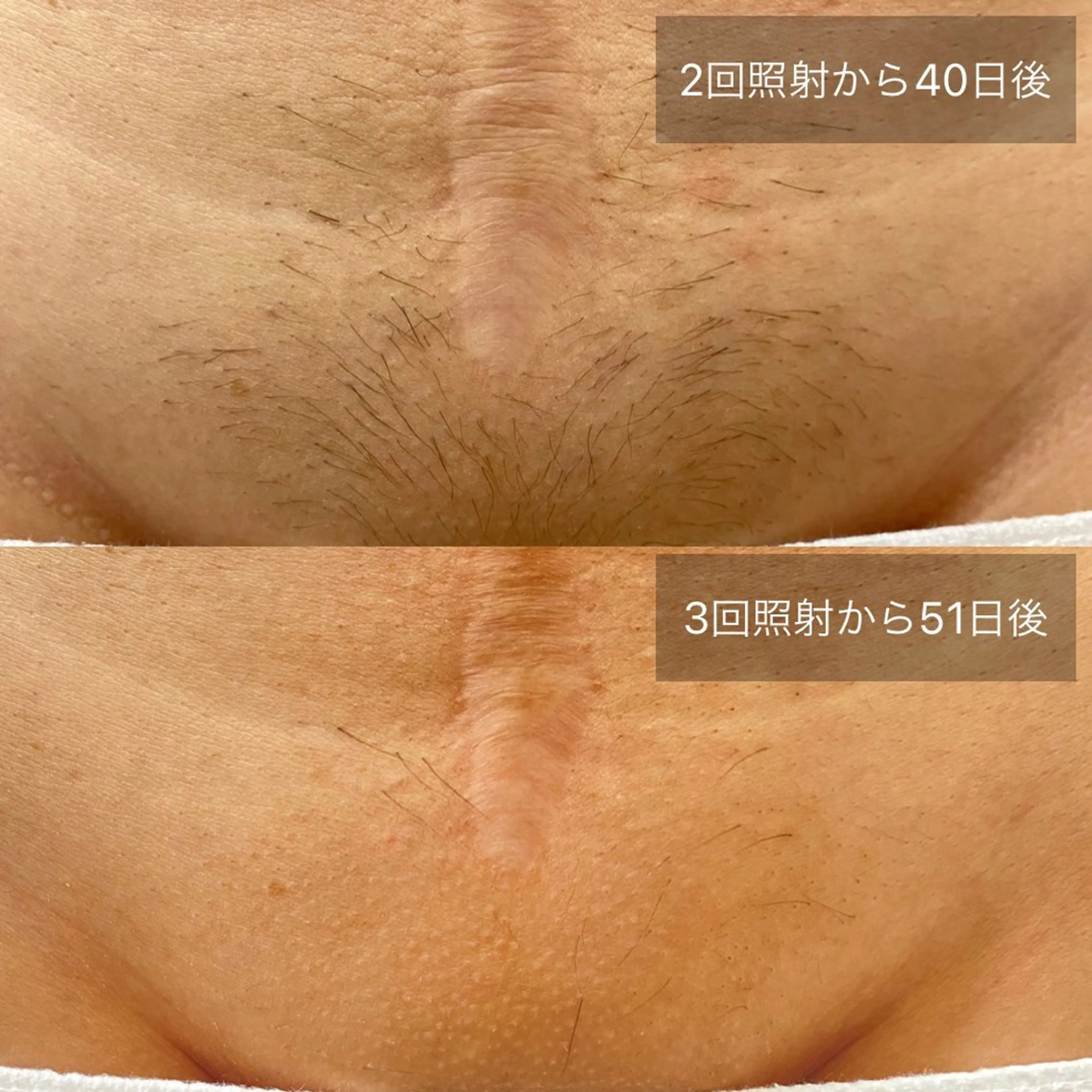 港区都度払い脱毛 miranjuのエステ・リラクイメージ