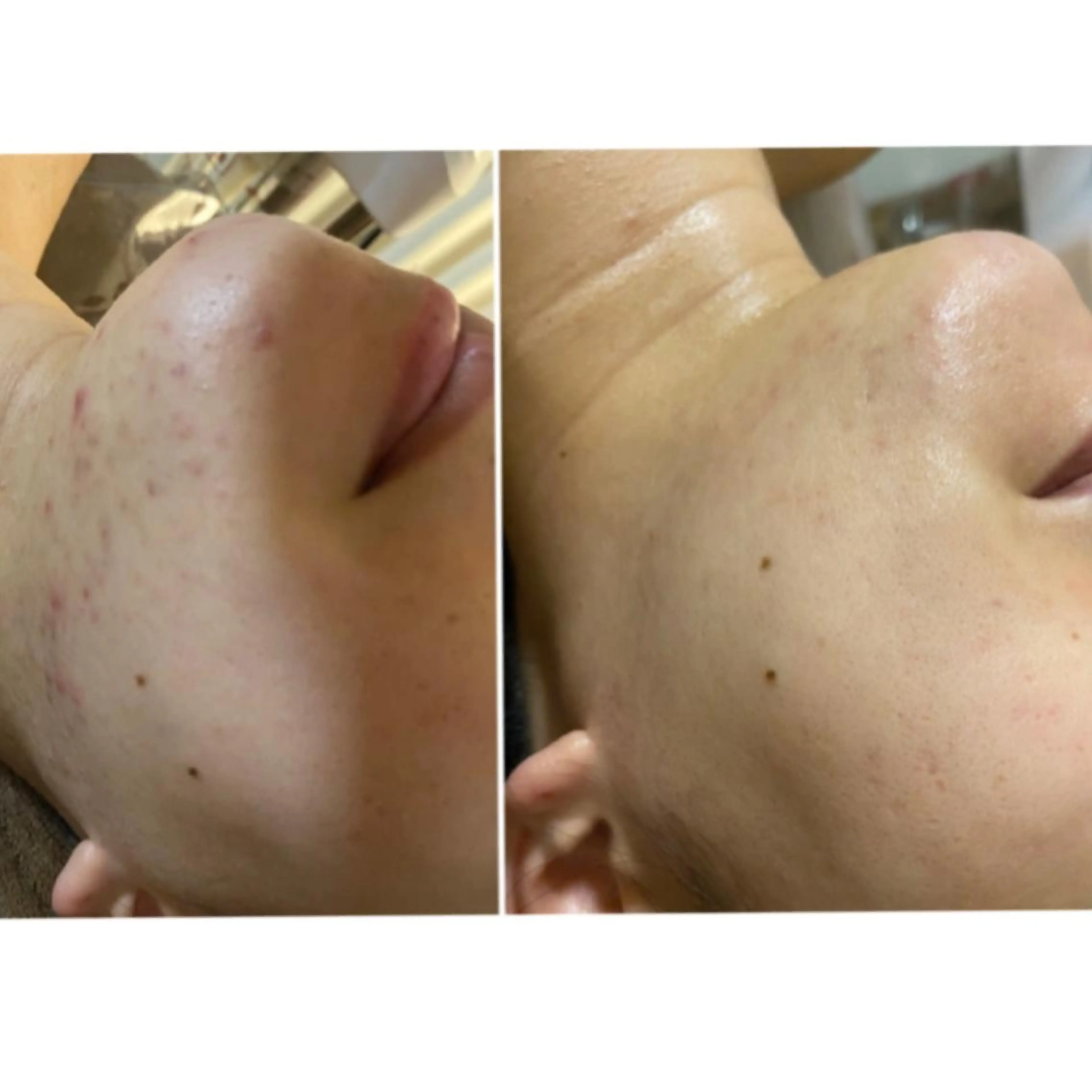 RAYVIS梅田店 FUJIのエステ・リラクイメージ