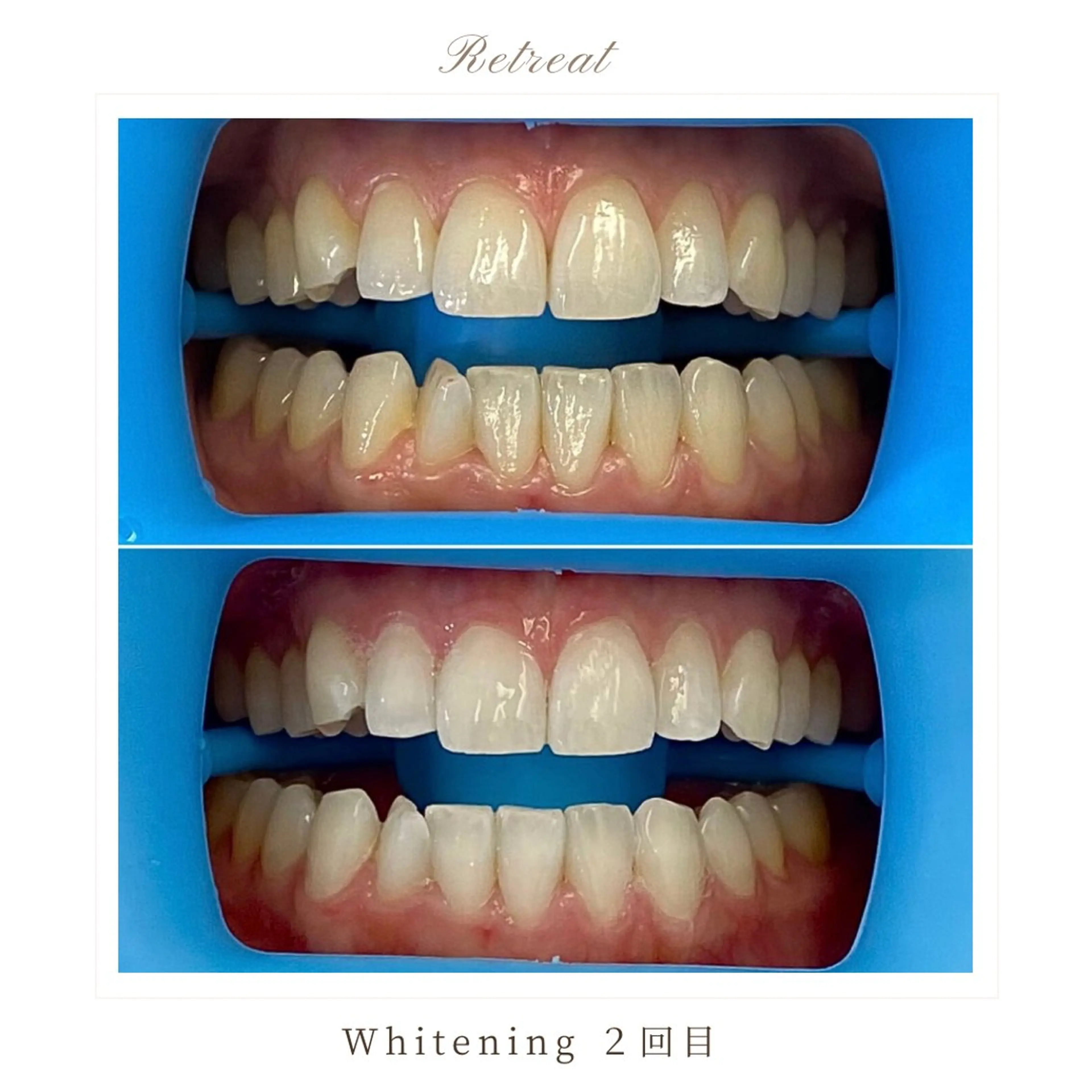 Retreatリトリート所属・歯科医院提携 Retreatのエステ・リラクイメージ