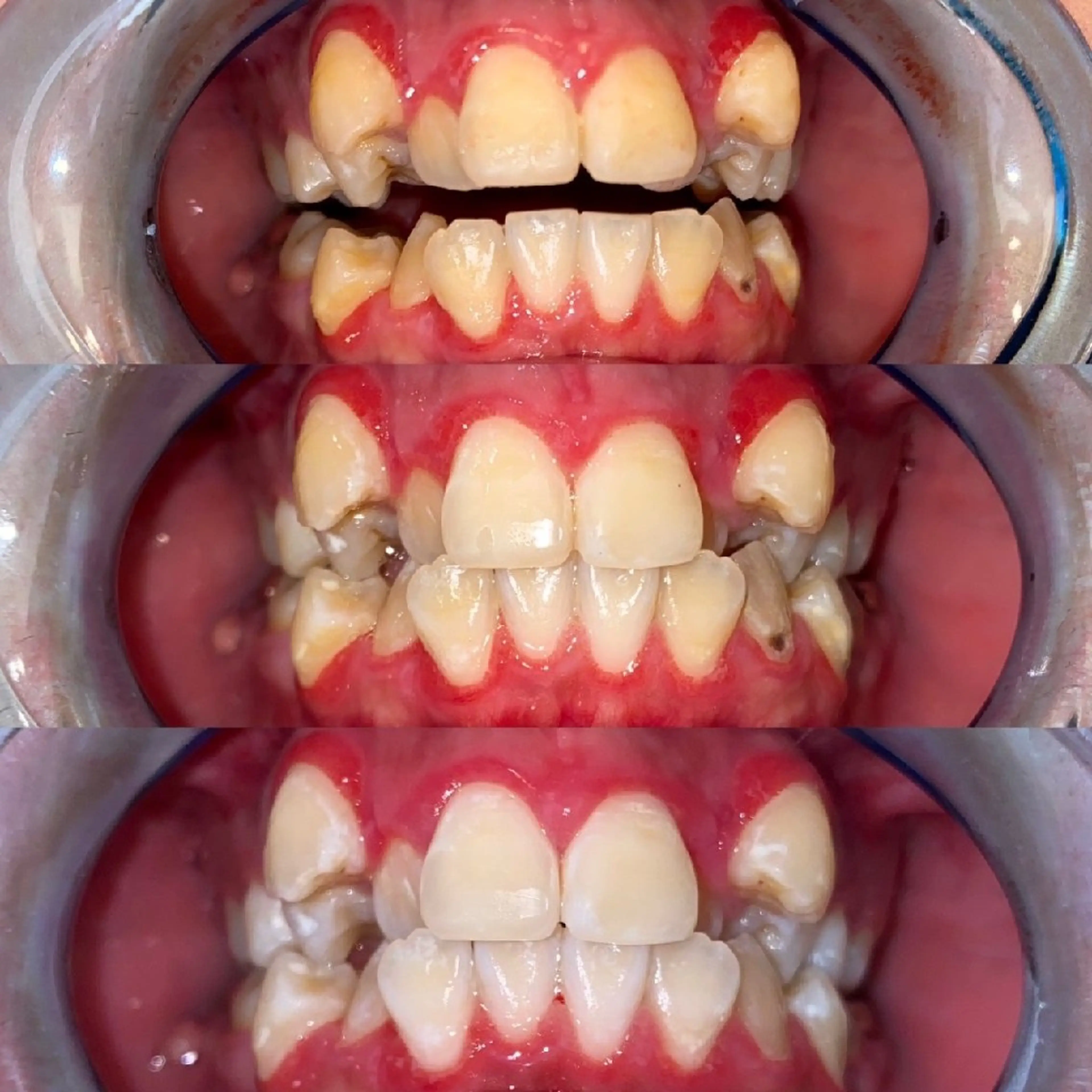 セルフホワイトニングビューティー三川店所属・中村 江梨香のその他イメージ