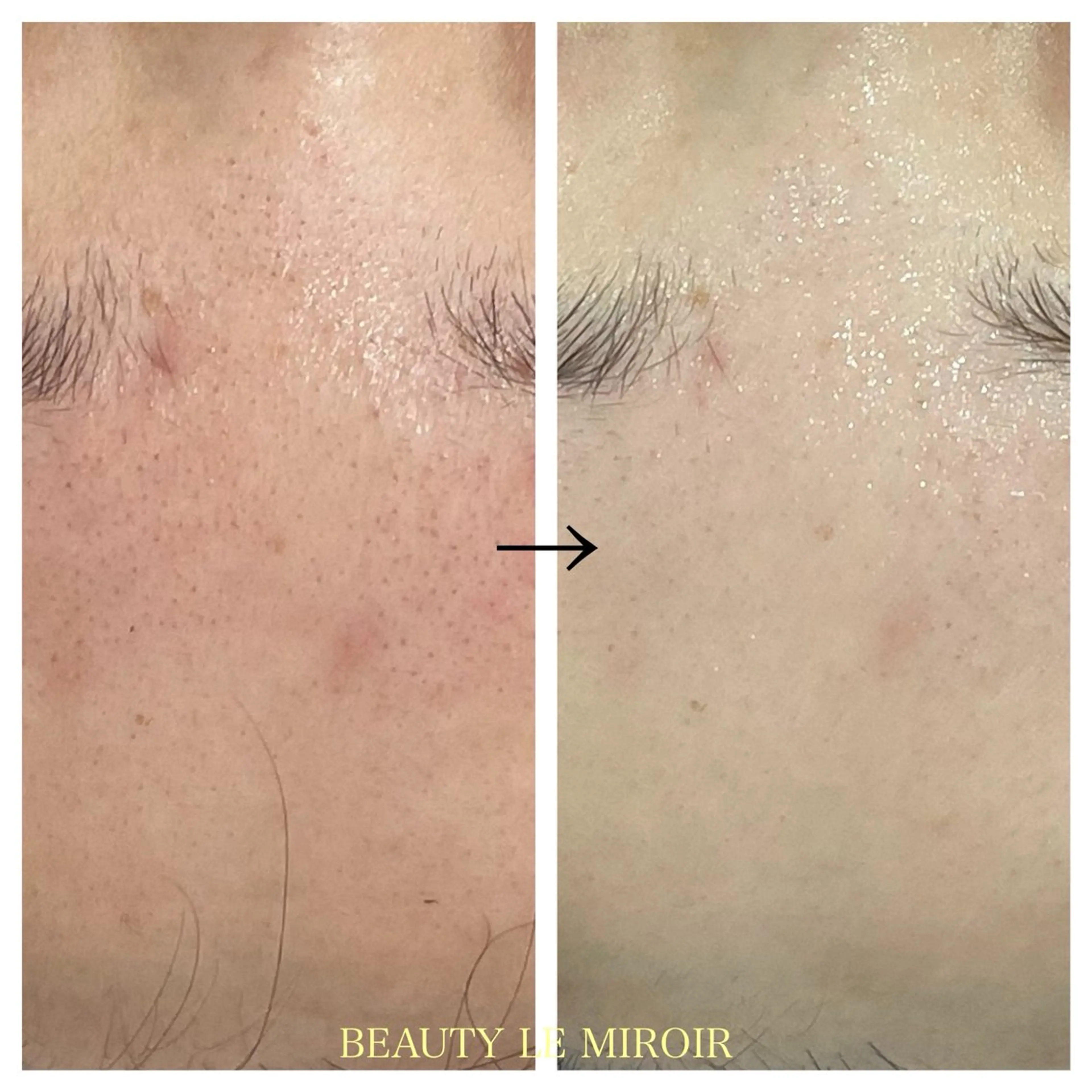 ビューティー ミロワールのエステ・リラクイメージ