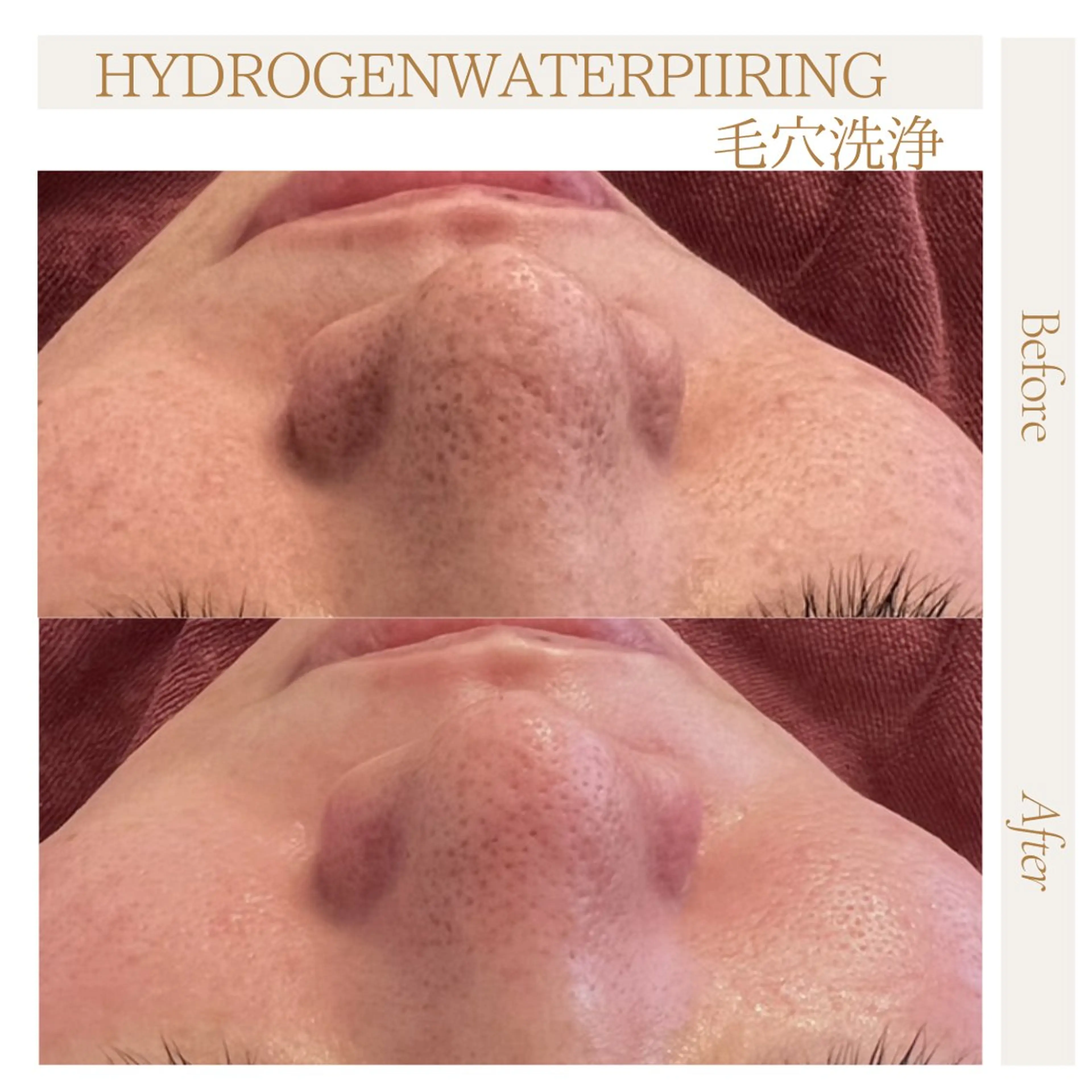 肌管理サロン neoriiのその他イメージ