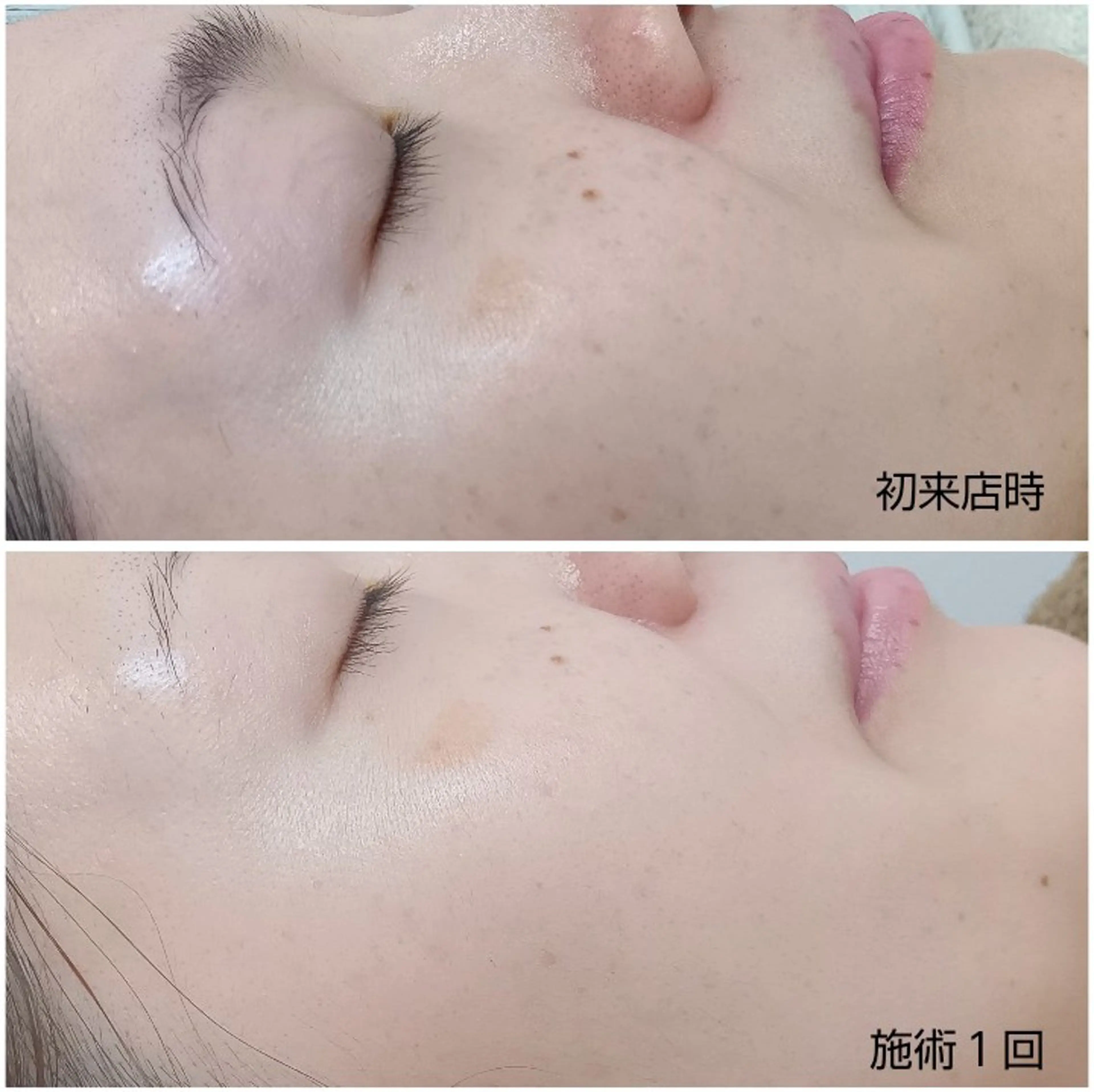 シミケア専門店 HAQUAのエステ・リラクイメージ