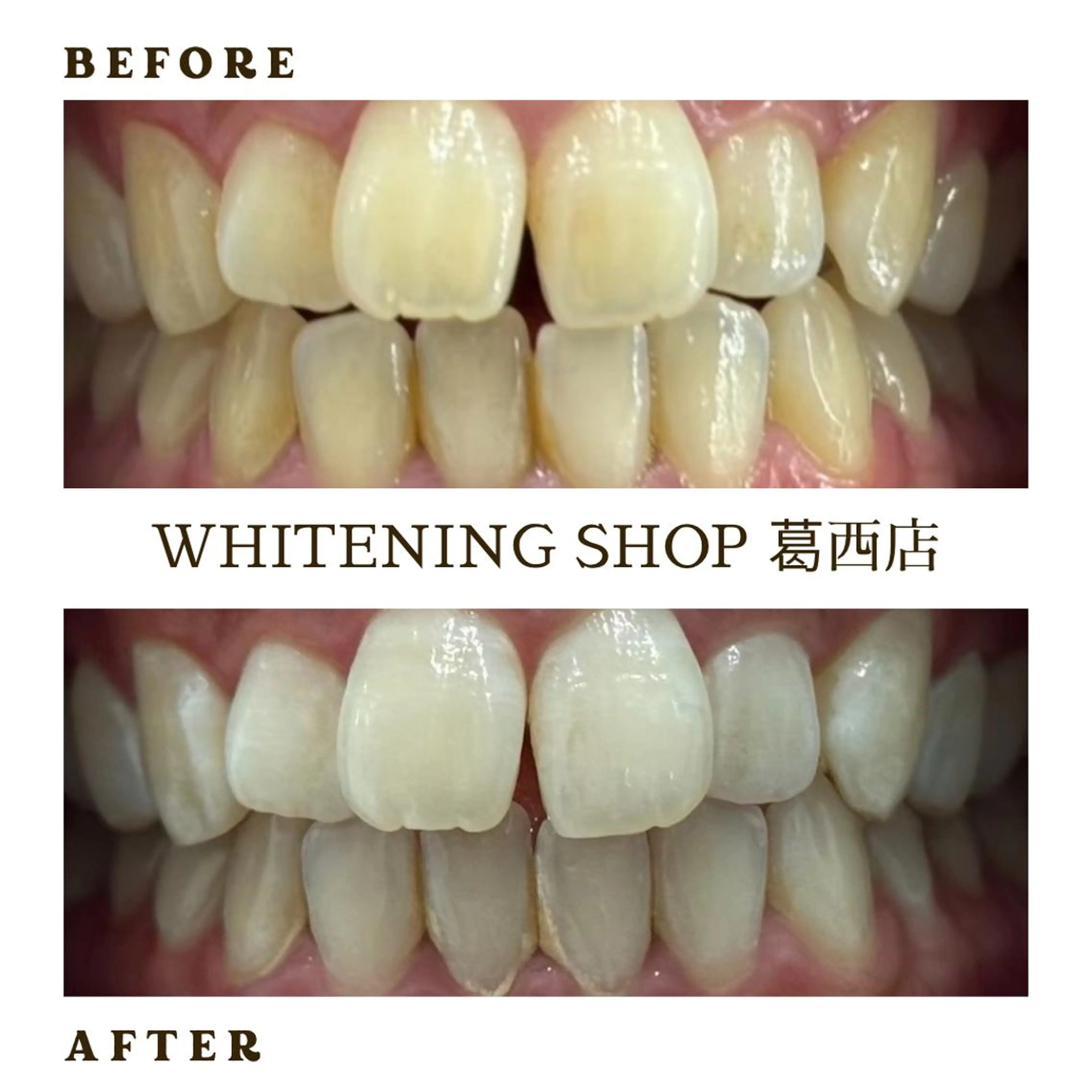 メンズ その他 ホワイトニング ショップ葛西店のその他イメージ