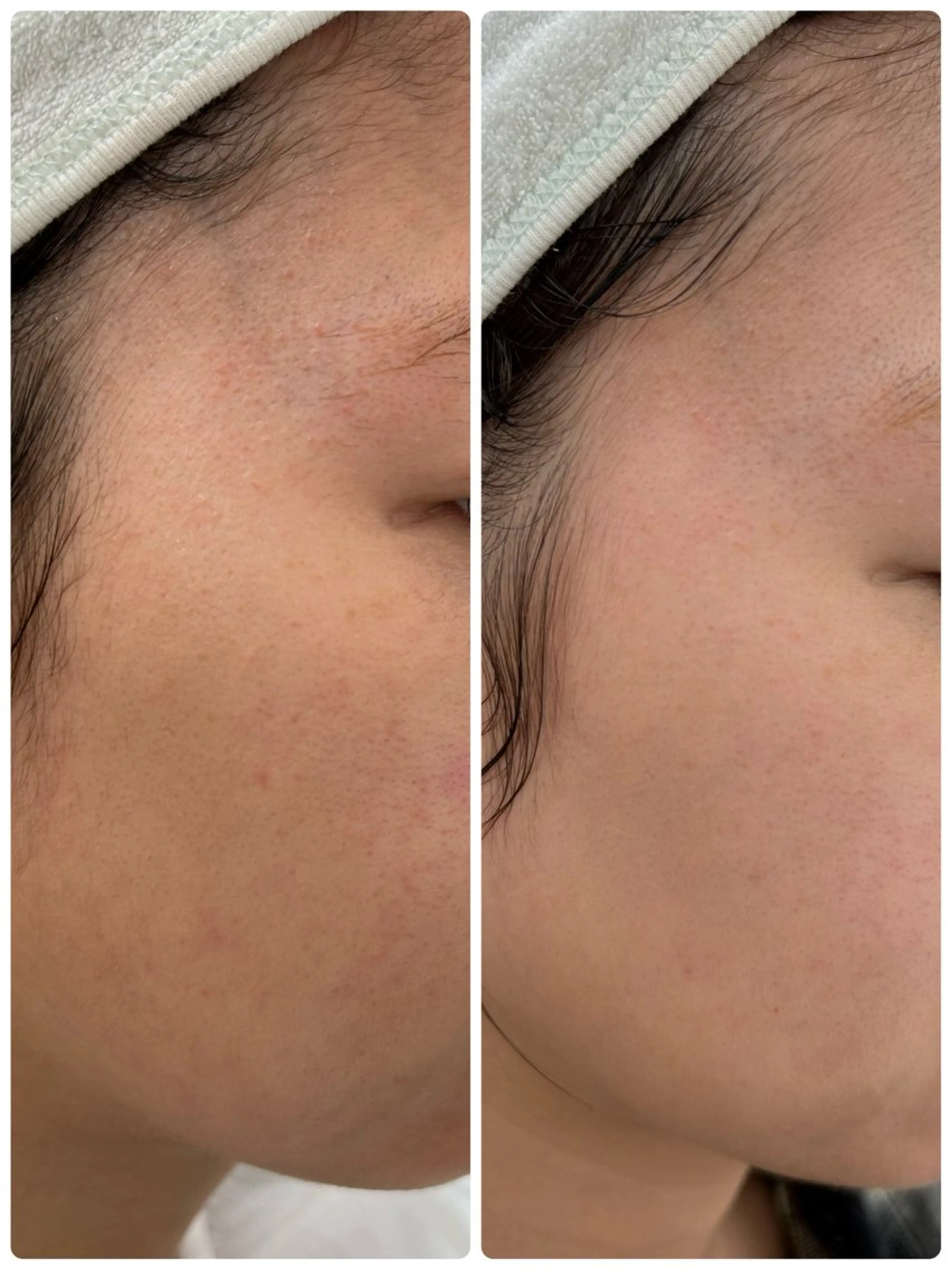 デアイム新潟北所属・フェイシャルエステ イダナツキのエステ・リラクイメージ