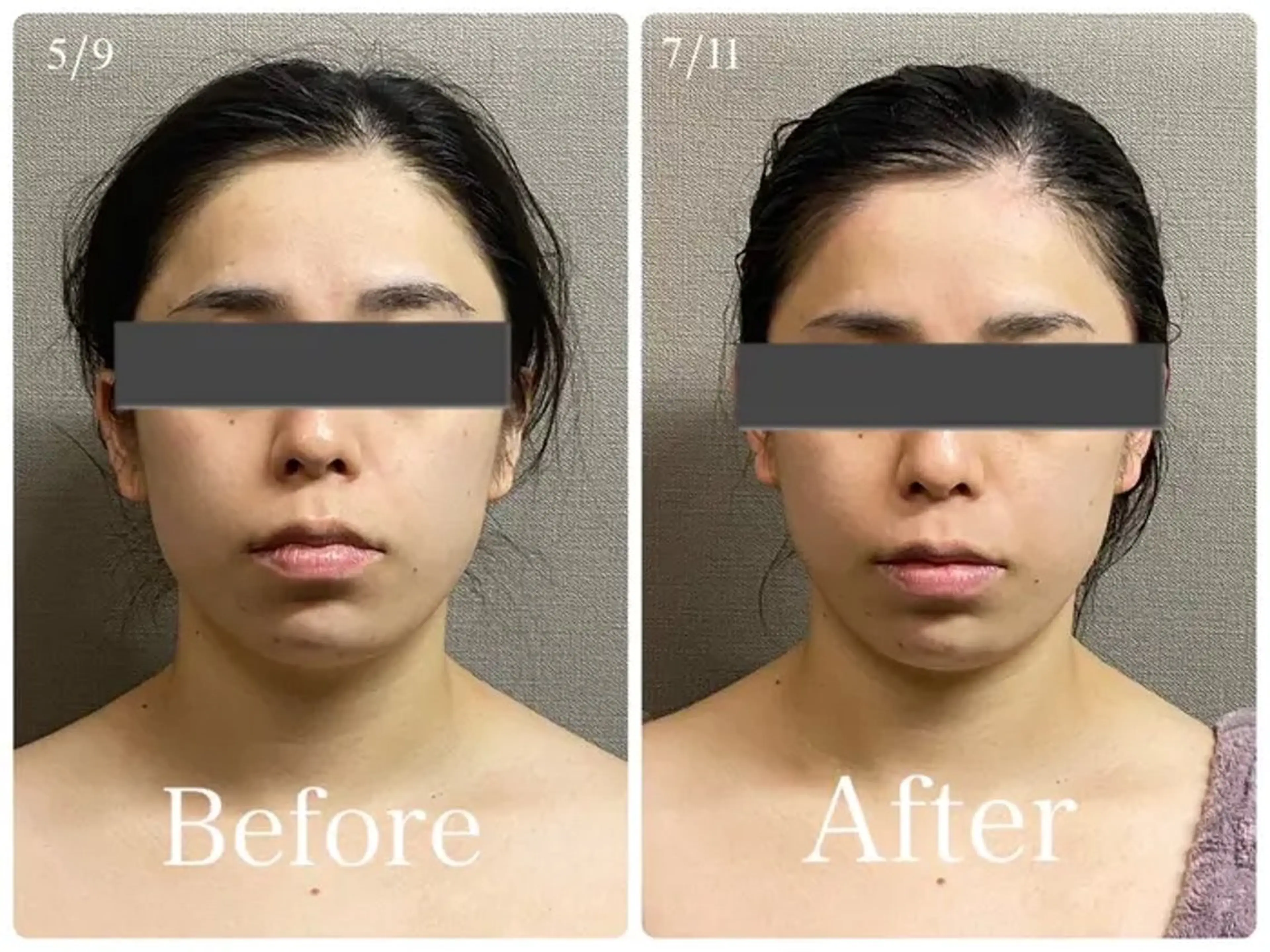 その他 MIRAI小顔 広島駅前店のエステ・リラクイメージ