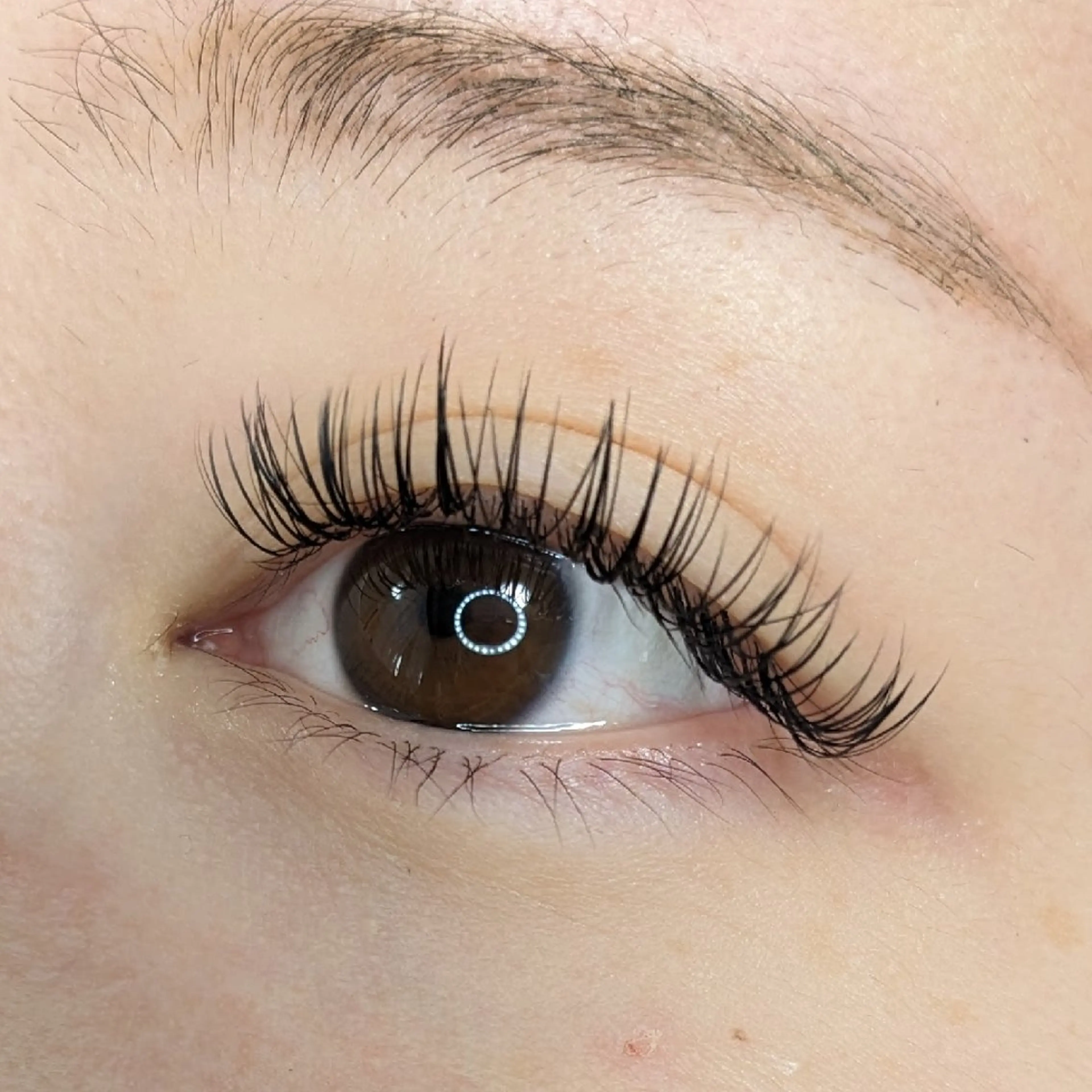 バインドロック（100束）の写真