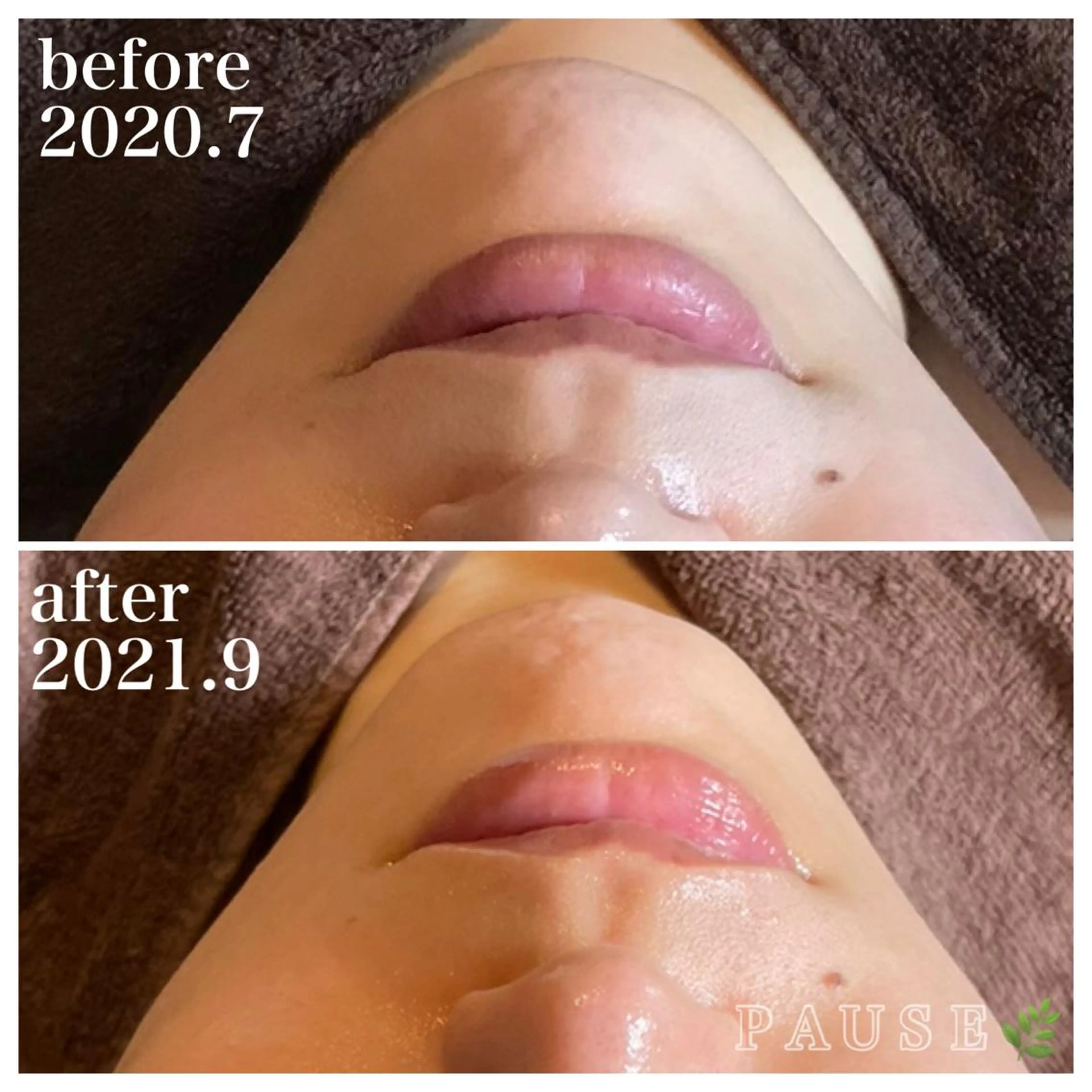 エステ 浜野 恵美のエステ・リラクイメージ