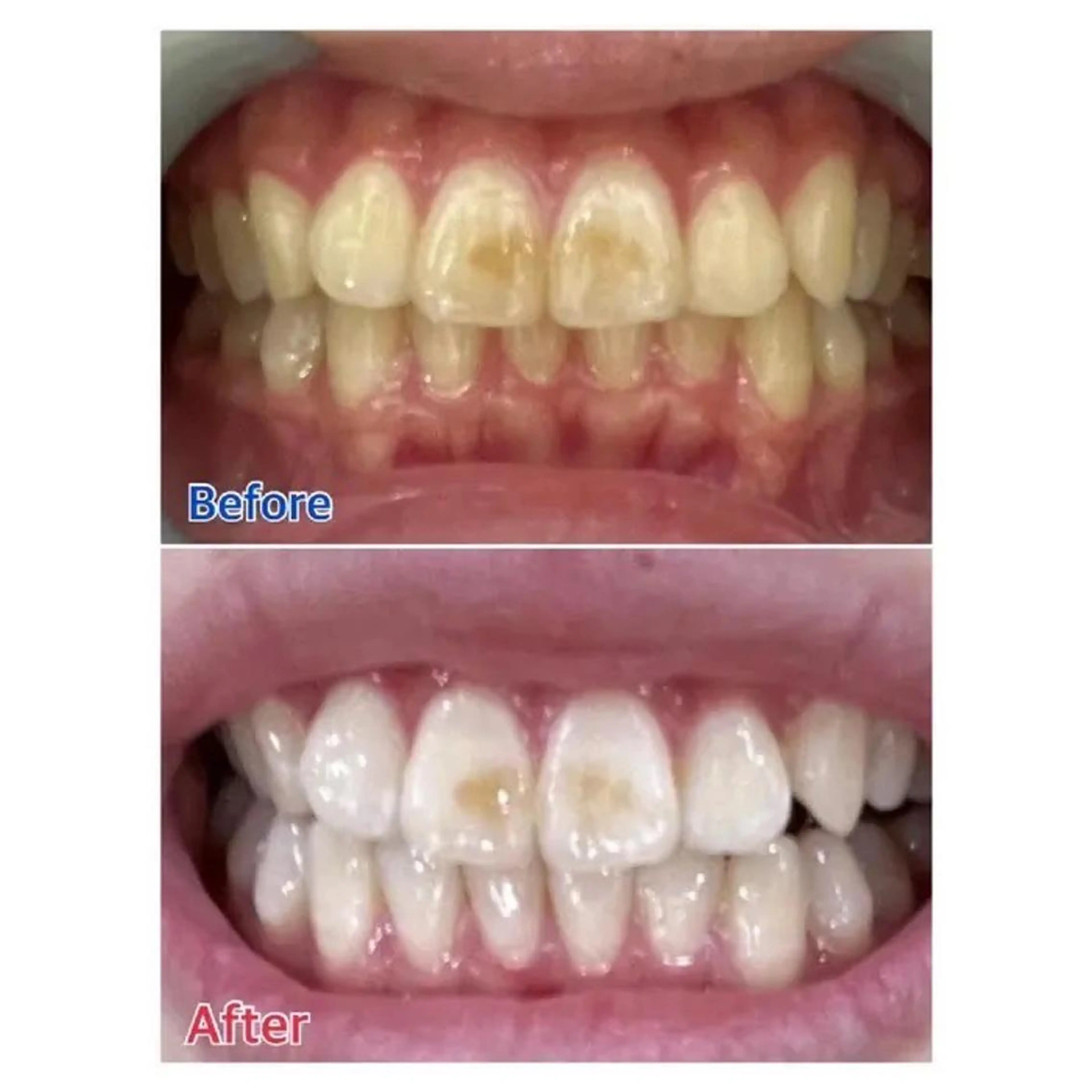 M渋谷 ホワイトニングのその他イメージ