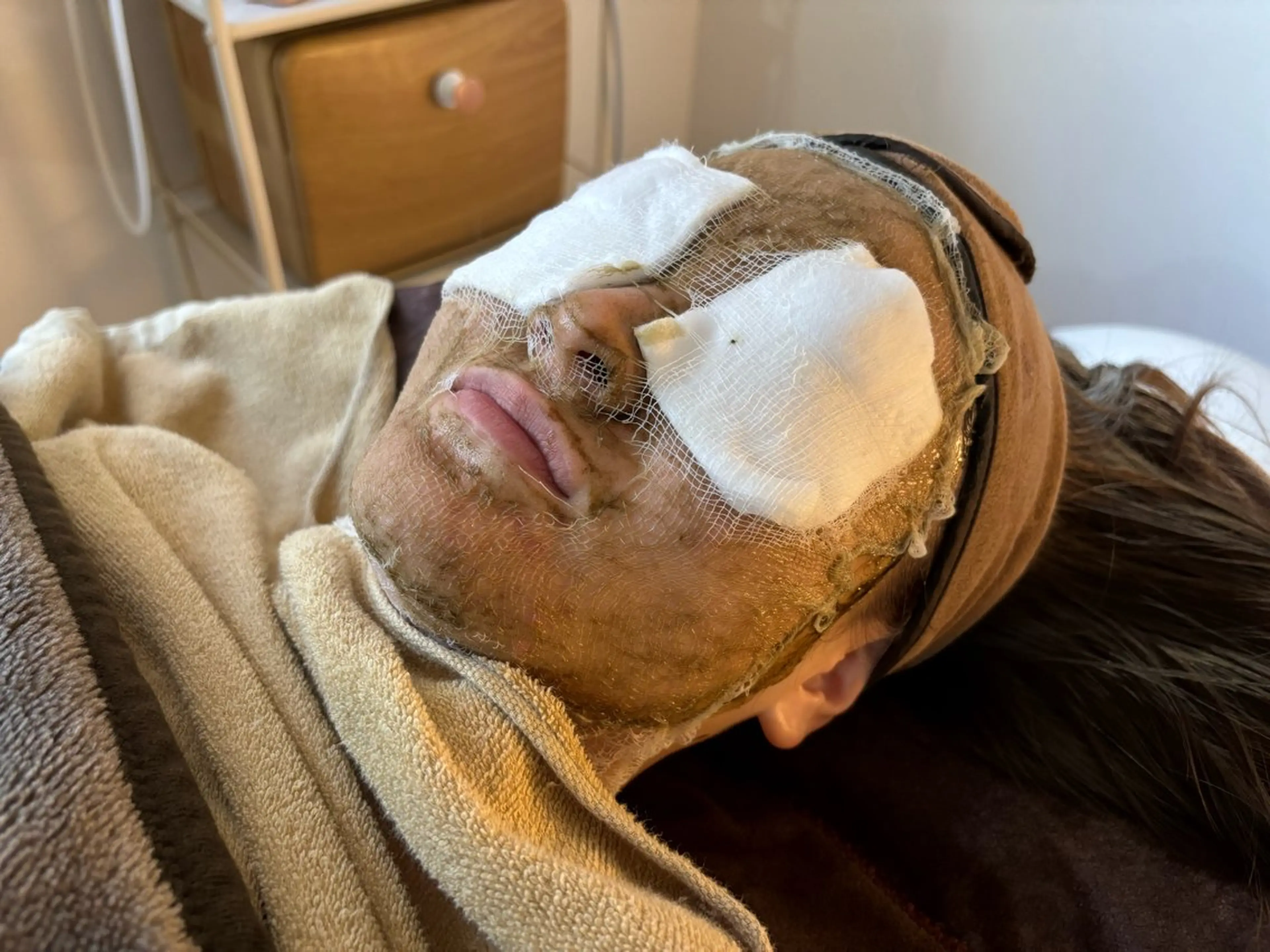 エステ ハーブピーリング🌿 Vivaceのエステ・リラクイメージ