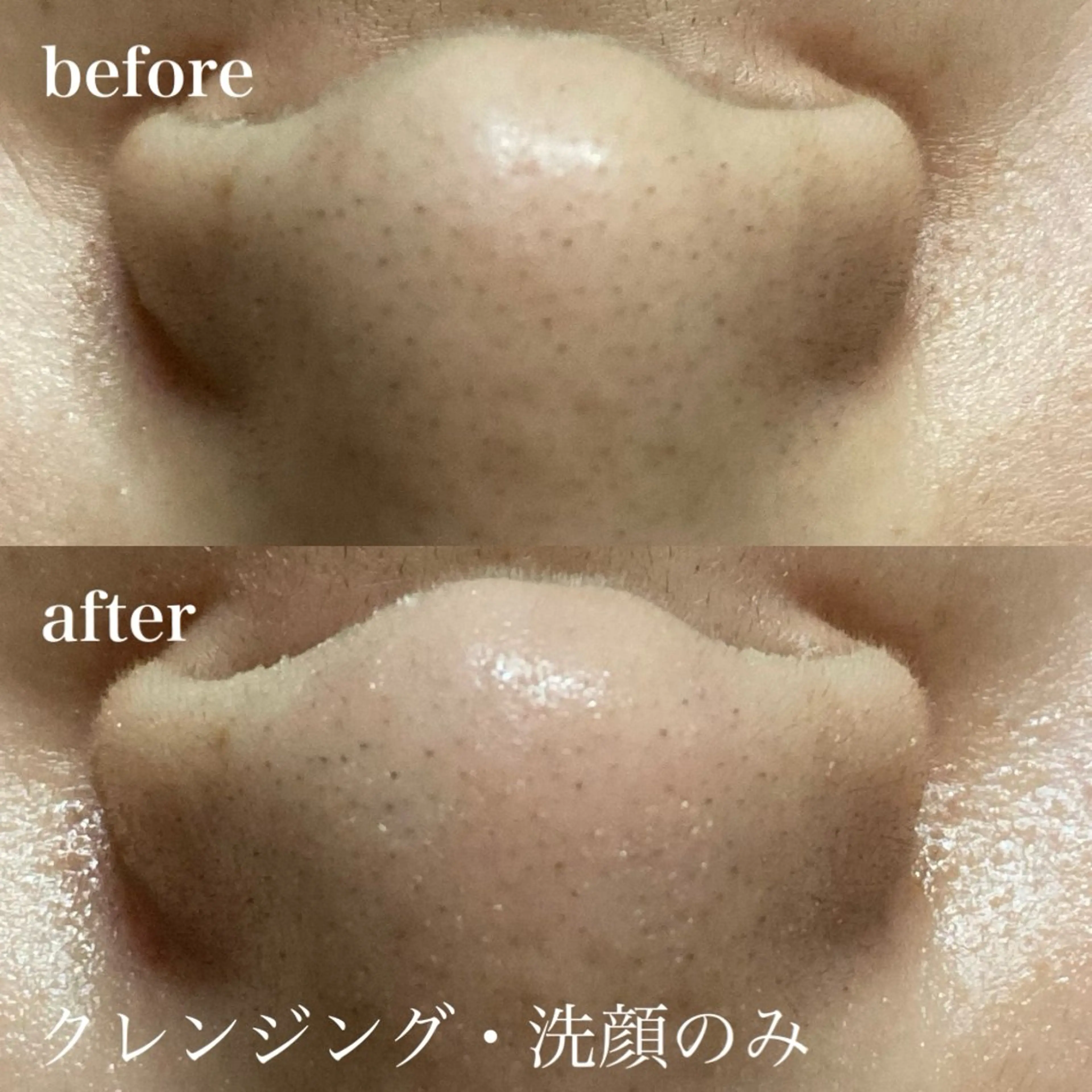 磐田｜LAYLA 一番丁寧な脱毛店のエステ・リラクイメージ