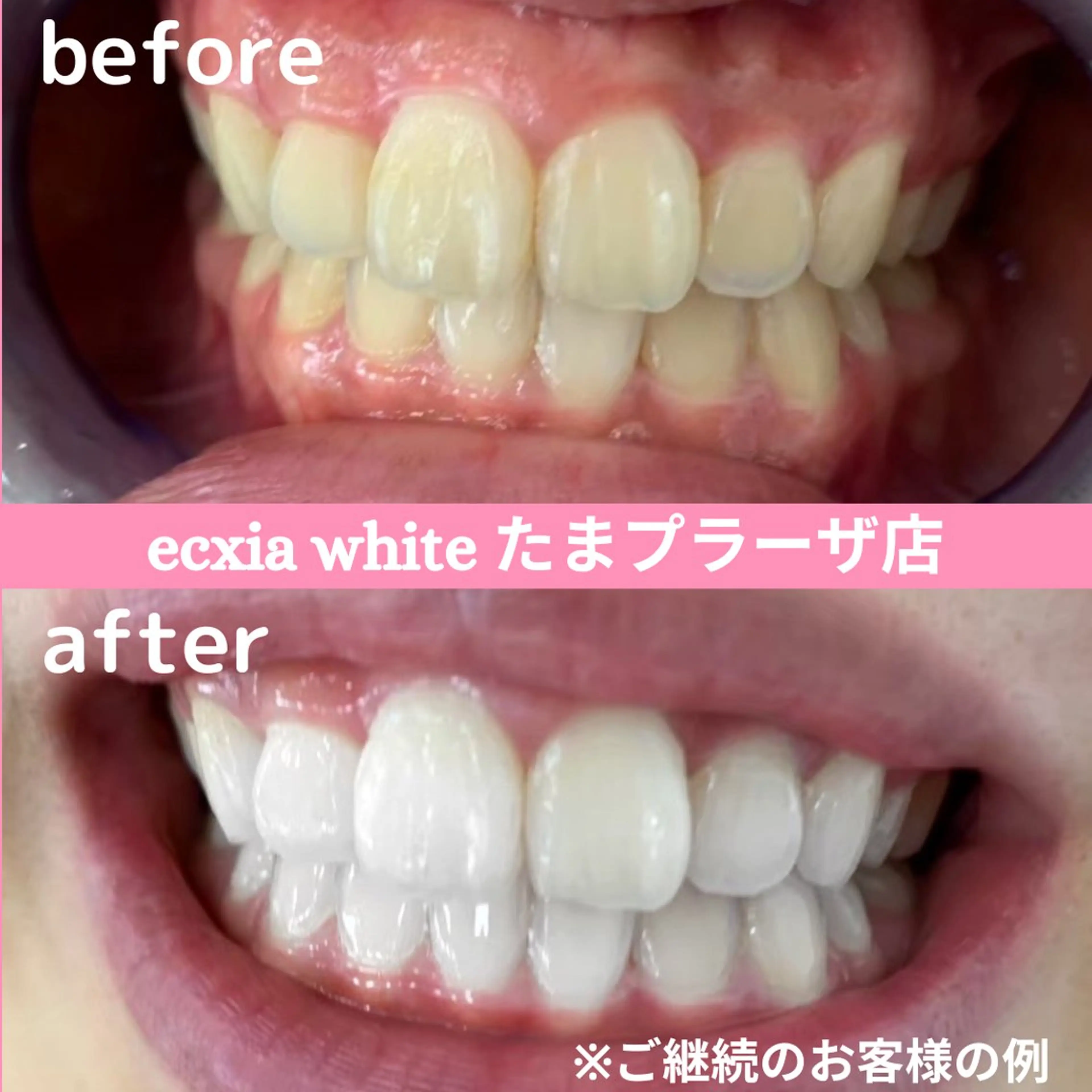 セルフホワイトニング　エクシアたまプラーザ店所属・yukari - オーナー -のその他イメージ