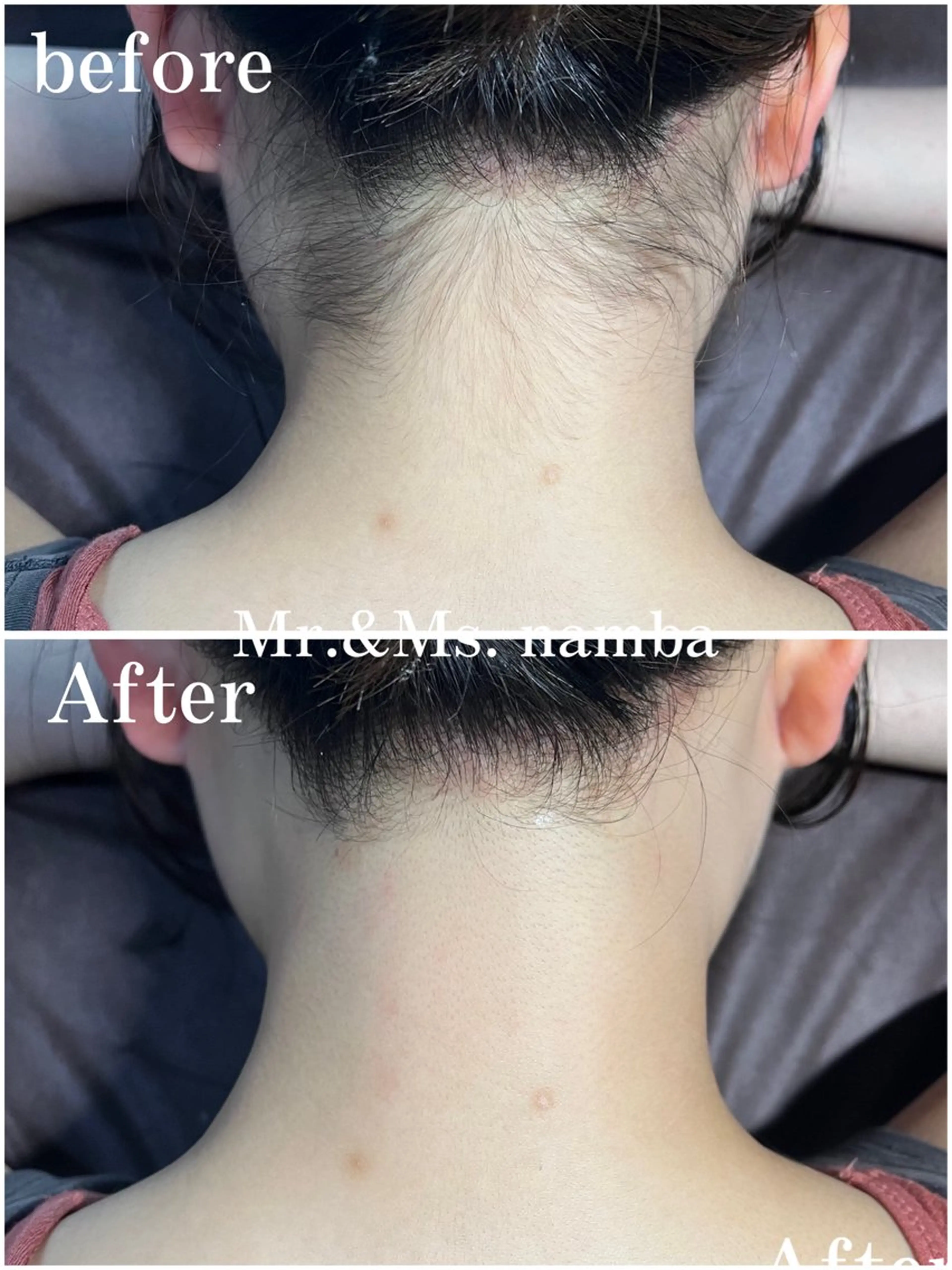 脱毛 Mr.&Ms. 脱毛 /眉毛ワックス/まゆのエステ・リラクイメージ