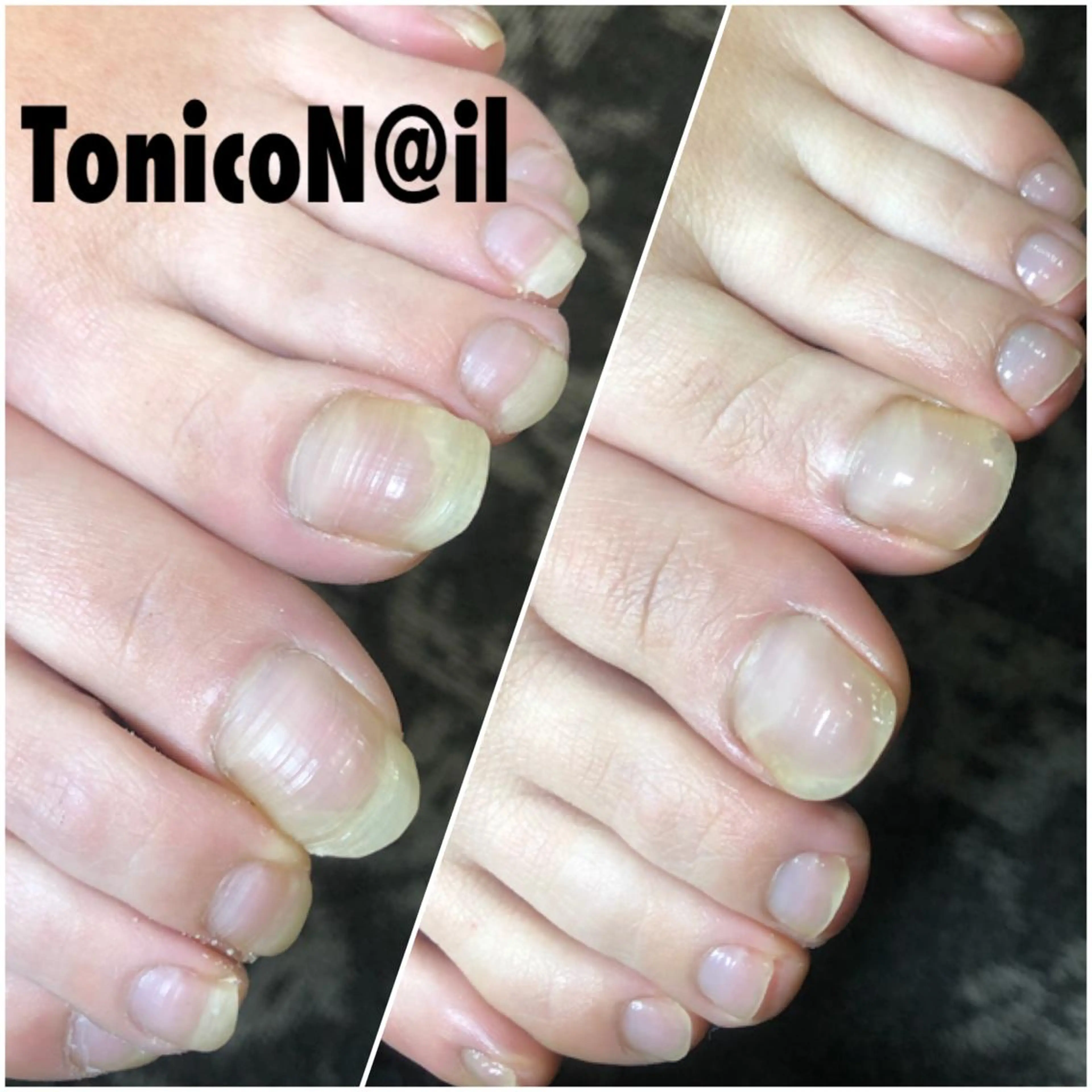 ネイル TonicoN@il トニコネイルのネイルデザイン