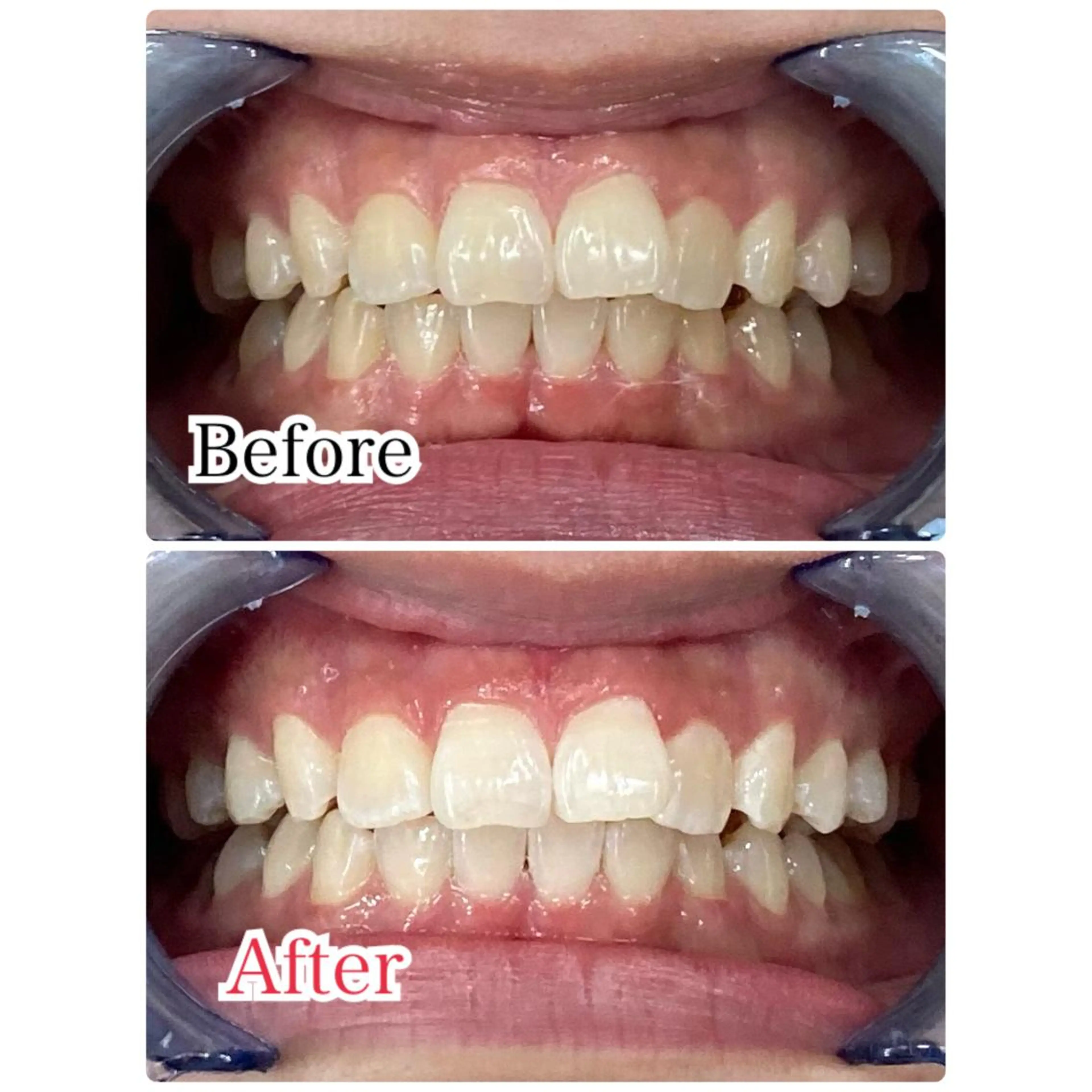 カラー メンズ キッズ ネイル マツエク・マツパ アイブロウ 【歯科提携】柏ホワイ トニングスタイルのその他イメージ