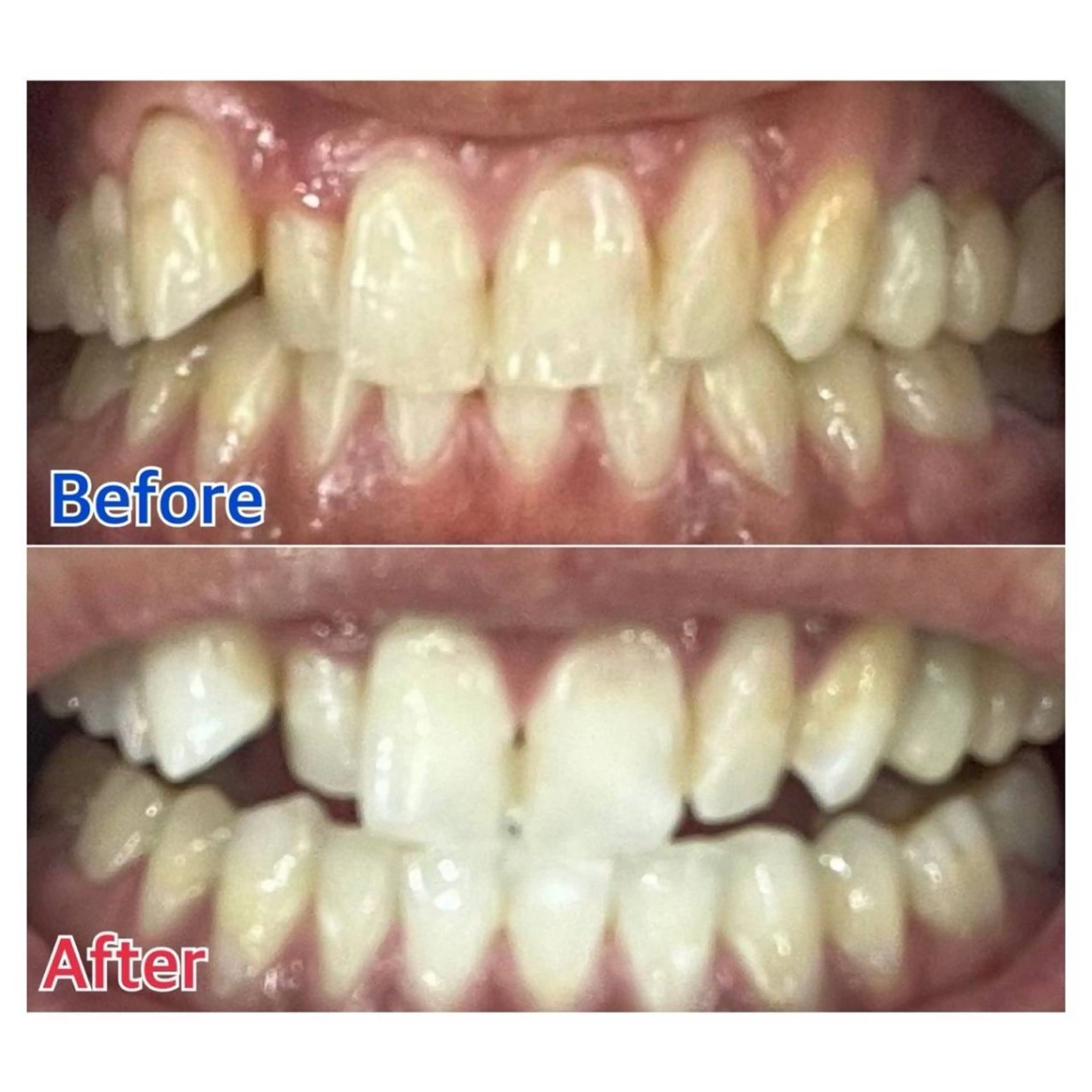 MBEAUTYSALON 千葉店・京成大久保所属・Melty 輝のその他イメージ