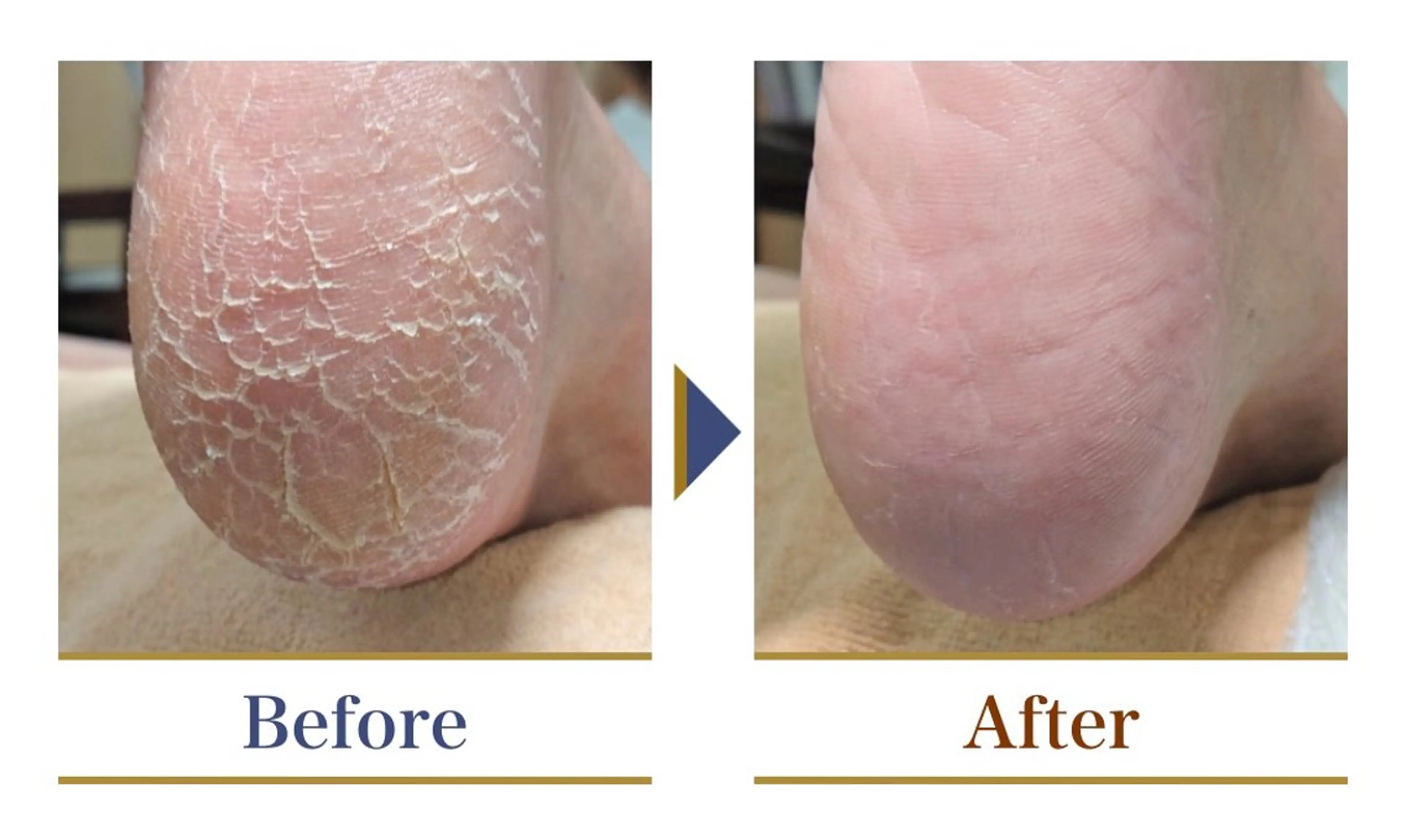 巻き爪補正店 横浜関内店のネイルデザイン